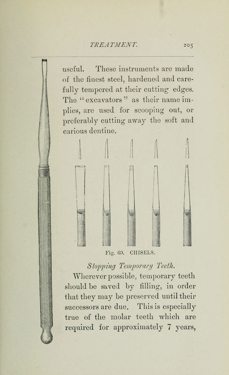 iisofiil. These instruments are made of the finest steel, hardened and care- fLilly tempered at their cutting; edges. The excavators as their name im- plies, are used for scooping out, or preferably cutting away the soft and carious dentine. ^ 4. r Fig. 69. CHISELS. Stopping Temporary Teeth. Wherever possible, temporary teeth should be saved by filling, in order that they may be preserved until their successors are due. This is especially true of the molar teeth which are required for approximately 7 years,
