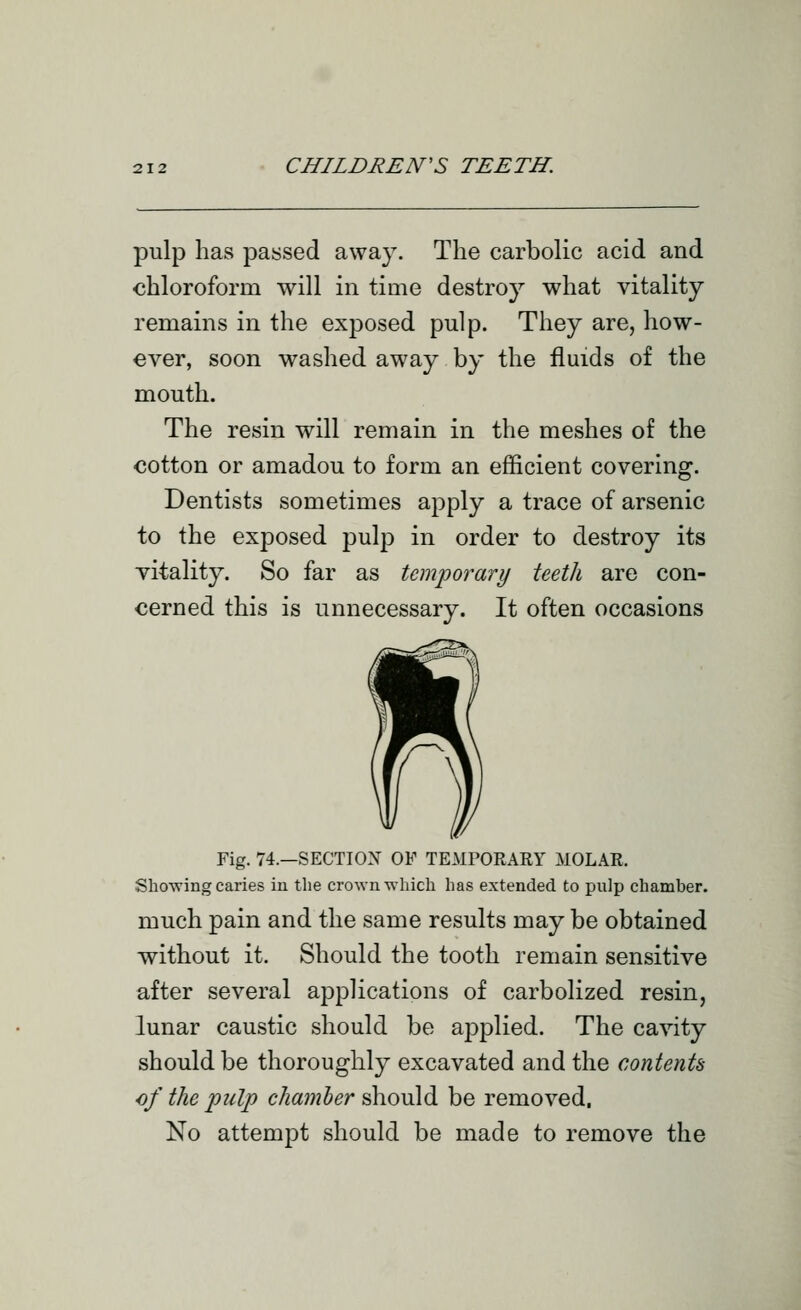 pulp has passed away. The carbolic acid and chloroform will in time destroy what vitality remains in the exposed pulp. They are, how- ever, soon washed away by the fluids of the mouth. The resin will remain in the meshes of the cotton or amadou to form an efficient covering. Dentists sometimes apply a trace of arsenic to the exposed pulp in order to destroy its vitality. So far as temporary teeth are con- cerned this is unnecessary. It often occasions Fig. 74.—SECTIOX OF TEMPORAEY MOLAR. Showing caries in the crown which has extended to pulp chamber. much pain and the same results may be obtained without it. Should the tooth remain sensitive after several applications of carbolized resin, lunar caustic should be applied. The cavity should be thoroughly excavated and the contents of the pulp chamber should be removed. No attempt should be made to remove the
