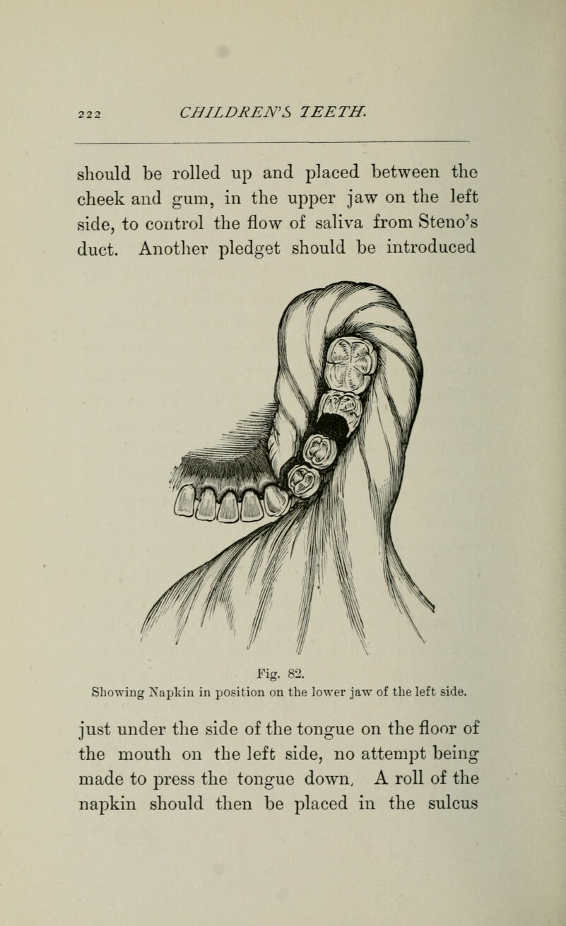 should be rolled up and placed between the cheek and gum, in the upper jaw on the left side, to control the flow of saliva from Steno's duct. Another pledget should be introduced Fig. 82. Showing Napkin in position on the lower jaw of the left side. just under the side of the tongue on the floor of the mouth on the left side, no attempt being made to press the tongue down, A roll of the napkin should then be placed in the sulcus