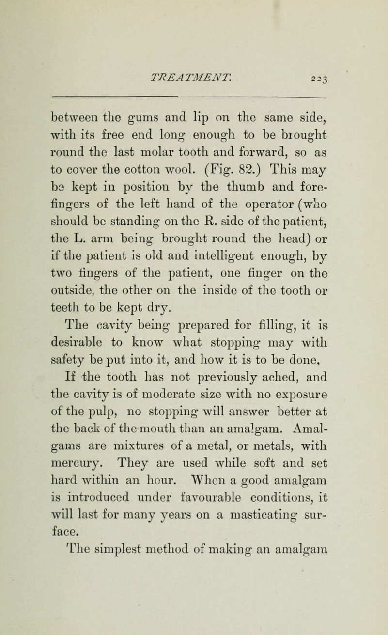 between the gums and lip on the same side, with its free end long enough to be brought round the last molar tooth and forward, so as to cover the cotton wool. (Fig. 82.) This may- be kept in position by the thumb and fore- fingers of the left hand of the operator (who should be standing on the R. side of the patient, the L. arm being brought round the head) or if the patient is old and intelligent enough, by two lingers of the patient, one finger on the outside, the other on the inside of the tooth or teeth to be kept dry. The cavity being prepared for filling, it is desirable to know what stopping may with safety be put into it, and how it is to be done. If the tooth has not previously ached, and the cavity is of moderate size with no exposure of the pulp, no stopping will answer better at the back of the mouth than an amalgam. Amal- gams are mixtures of a metal, or metals, with mercury. They are used while soft and set hard within an hour. When a good amalgam is introduced under favourable conditions, it will last for many years on a masticating sur- face. The simplest method of making an amalgam