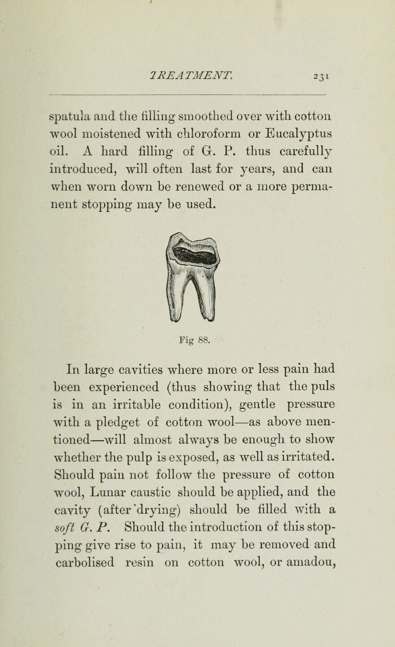spatula and tlie filling smoothed over with cotton wool moistened with chloroform or Eucalyptus oil. A hard filling of G. P. thus carefully introduced, will often last for years, and can when worn down be renewed or a more perma- nent stopping may be used. Fier In large cavities where more or less pain had been experienced (thus showing that the puis is in an irritable condition), gentle pressure with a pledget of cotton wool—as above men- tioned—will almost always be enough to show whether the pulp is exposed, as well as irritated. Should pain not follow the pressure of cotton wool, Lunar caustic should be applied, and the cavity (after drying) should be filled with a 8oft G. p. Should the introduction of this stop- ping give rise to pain, it may be removed and carbolised resin on cotton wool, or amadou,