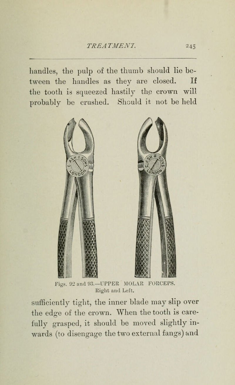 handles, the pulp of the thumb should lie be- tween the handles as they are closed. If the tooth is squeezed hastily the crown will probably be crushed. Should it not be held Figs. 92 and 93.—UPPER MOLAR FORCEPS. Right and Left. sufficiently tight, the inner blade may slip over the edo^e of the crown. When the tooth is care- fully grasped, it should be moved slightly in- wards (to disengage the two external fangs) and