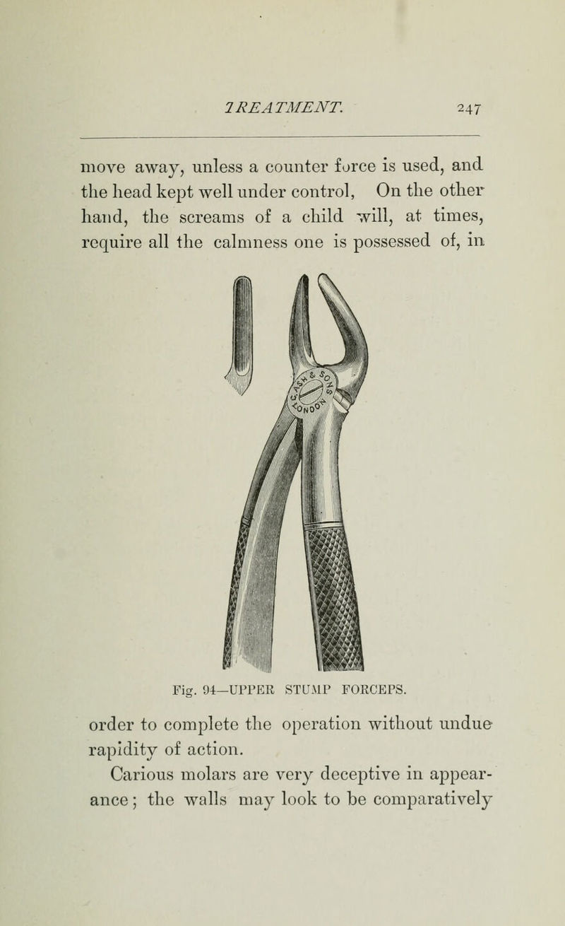move away, unless a counter force is used, and the head kept well under control, On the other hand, the screams of a child will, at times, require all the calmness one is possessed of, in Fig. 94—UPPER STUMP FORCEPS. order to complete the operation without undue rapidity of action. Carious molars are very deceptive in appear- ance ; the walls may look to be comparatively