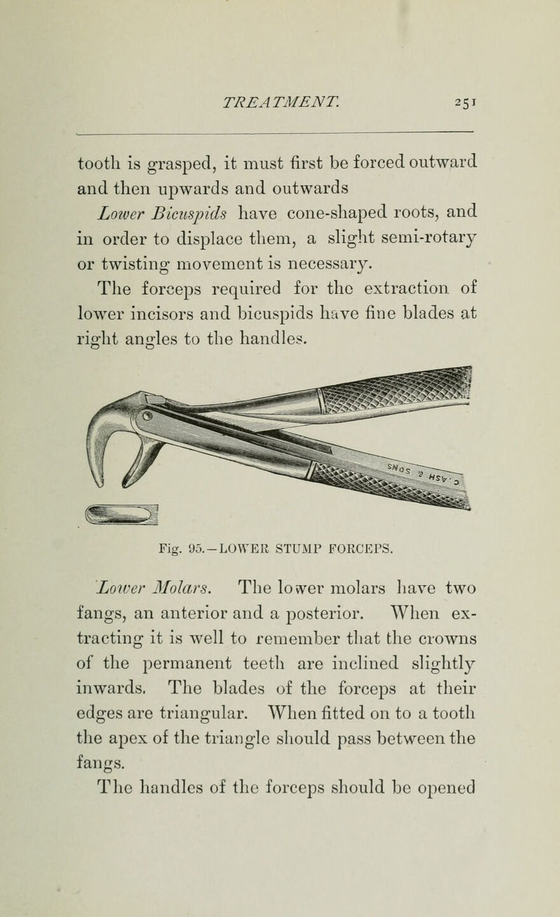 tooth is grasped, it must first be forced outward and then upwards and outwards Lower Bicuspids have cone-shaped roots, and in order to displace them, a sliglit semi-rotary or twisting movement is necessary. The forceps required for the extraction, of lower incisors and bicuspids have fine blades at riffht anjrles to the handles. Fig. 95.-LOWER STUMP FORCEPS. Lower Molars. The lower molars have two fangs, an anterior and a posterior. When ex- tracting it is well to remember that the crowns of the permanent teeth are inclined slightly inwards. The blades of the forceps at their edges are triangular. When fitted on to a tooth the apex of the triangle should pass between the fangs. The handles of the forceps should be opened