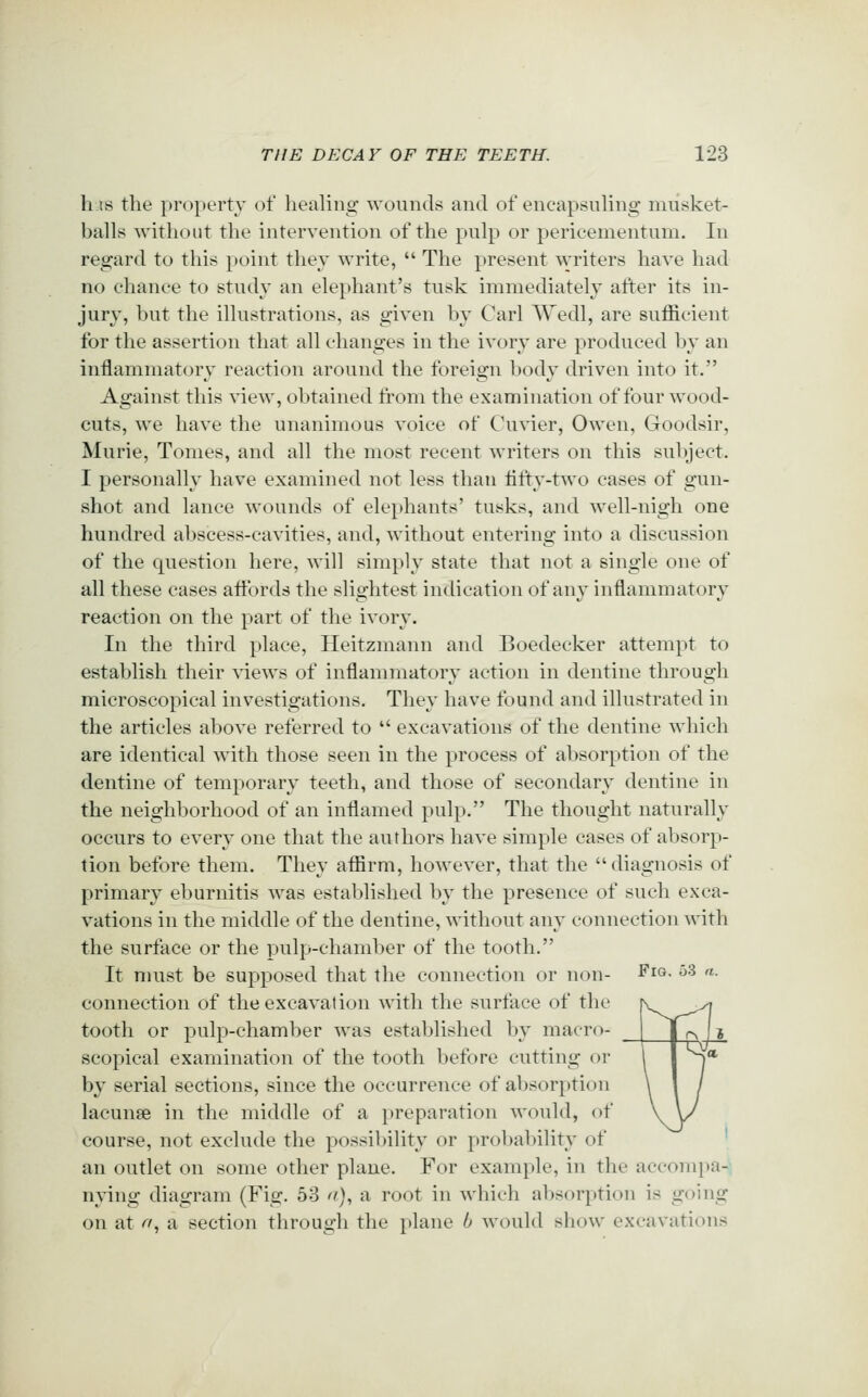 his the property of healing wounds and of encapsuhng musket- balls without the intervention of the pulp or pericementum. In regard to this point they write,  The present writers have had no chance to study an elephant's tusk immediately after its in- jury, but the illustrations, as given by Carl AVedl, are sufficient for the assertion that all changes in the ivory are produced by an inflammatory reaction around the foreign body driven into it. Against this view, obtained li'om the examination of four wood- cuts, we have the unanimous voice of Cu\'ier, Owen, Goodsir, Murie, Tomes, and all the most recent writers on this subject. I personally have examined not less than lifty-two cases of gun- shot and lance wounds of elephants' tusks, and well-nigh one hundred abscess-cavities, and, without entering into a discussion of the question here, will simply state that not a single one of all these cases attbrds the slightest indication of any inflammatory reaction on the part of the ivory. In the third place, Heitzmann and Boedecker attempt to establish their views of inflammatory action in dentine through microscopical investigations. They have found and illustrated in the articles aljove referred to  excavations of the dentine which are identical with those seen in the process of absorption of the dentine of temporary teeth, and those of secondary dentine in the neighborhood of an inflamed pulp. The thought naturally occurs to every one that the authors have simple cases of absorp- tion before them. They affirm, however, that the diagnosis of primary eburnitis was established by the presence of such exca- vations in the middle of the dentine, without any connection with the surface or the pulp-chamber of the tooth. It must be supposed that the connection or non- ^lo- ^^ ■■ connection of the excavation with the surface of the tooth or pulp-chamber was established by macro- scopical examination of the tooth before cutting or by serial sections, since the occurrence of absorption lacunse in the middle of a preparation would, of course, not exclude the possibility or probability of an outlet on some other plane. For example, in the accompa- nying diagram (Fig. 58 a)^ a root in which absorption is going on at f^', a section through the plane b would show excavations