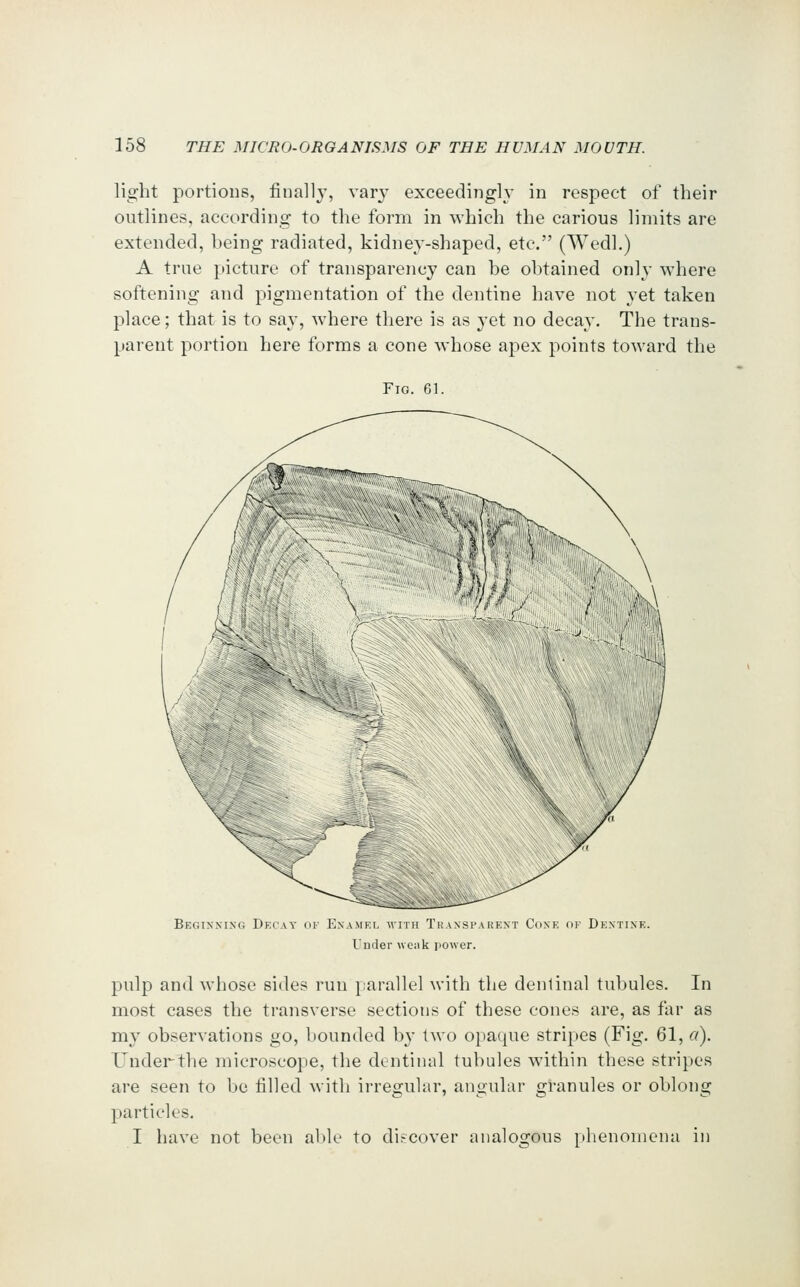 light portions, finally, var^' exceedingly in respect of their outlines, according to the form in which the carious limits are extended, being radiated, kidney-shaped, etc. (Wedl.) A true picture of transparency can be obtained only where softening and pigmentation of the dentine have not yet taken place; that is to say, where there is as yet no decay. The trans- parent portion here forms a cone whose apex points toward the Fig. 61. Begixsixg Decay ok Enamel mith Thansi'auext Coxe or Dextixe. I'nder weiik power. pulp and whose sides run parallel with the dentinal tubules. In most cases the transverse sections of these cones are, as far as my observations go, bounded by two opaque stripes (Fig. 61, a). Uuderthe microscope, the dentinal tubules within these stripes are seen to be filled with irres^ular, anjiuhir granules or oblong particles, I have not been al)le to discover analogous plienomena in