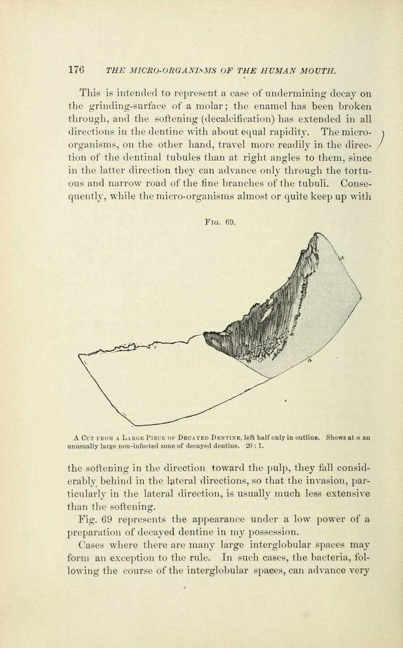 Tliis is intended to represent a case of undermining decay on the grinding-surface of a molar; tlie enamel lias been broken througli, and tlie softening (decalcification) lias extended in all directions in the dentine with about equal rapidity. The micro- organisms, on the other hand, travel more readily in the direc- tion of the dentinal tubules than at right angles to them, since in the latter direction they can advance only through the tortu- ous and narrow road of the fine branches of the tubuli. Conse- quently, while the micro-organisms almost or quite keep up with Fig. 69. A Cut from a Large Piece of Decayed Dentine, left half only in outline. Shows at a an unusually large non-infected zone of decayed dentine. 20 :1. the softening in the direction toward the pulp, they fall consid- erably behind in the lateral directions, so that the invasion, par- ticularly in the lateral direction, is usually much less extensive than the softening. Fig. 69 represents the appearance under a low power of a preparation of decayed dentine in my possession. Cases where there are many large interglobular spaces may form an exception to the rule. In such cases, the bacteria, fol- lowing the course of the interglobular spaces, can advance very