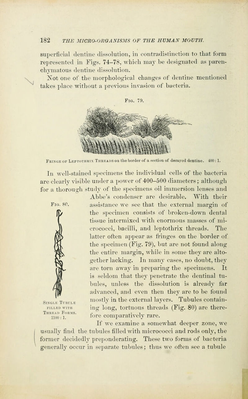 \i superficial deiitine dissolution, in contradistinction to that form represented in Figs. 74-78, which may be designated as paren- chymatous dentine dissolution, Not one of the morphological changes of dentine mentioned takes place without a previous invasion of bacteria. Fig. 79. Fig. 80. Fringe of Leptothrix Threads on the border of a suction of decayed dentine. 400:1. In well-stained specimens the individual cells of the bacteria are clearly visible under a power of 400-500 diameters; although for a thorouo-h study of the specimens oil immersion lenses and Abbe's condenser are desirable. With their assistance we see that the external margin of the specimen consists of broken-down dental tissue intermixed with enormous masses of mi- crococci, bacilli, and leptothrix threads. The latter often appear as fringes on the border of the specimen (Fig. 79), but are not found along the entire margin, while in some they are alto- gether lacking. In many cases, no doubt, they are torn away in preparing the specimens. It is seldom that they penetrate the dentinal tu- bules, unless the dissolution is already far advanced, and even then they are to be found mostly in the external layers. Tubules contain- ing long, tortuous threads (Fig. 80) are there- fore comparatively rare. If we examine a somewhat deeper zone, we usually find the tubules filled with micrococci and rods only, the former decidedly preponderating. These two forms of bacteria generally occur in separate tubules; thus we often see a tubule Single Tubule filled with Thread Forms. nOO:]. I