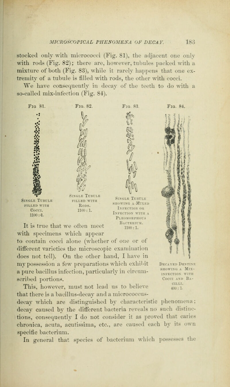 MICROSCOPICAL PHENOMENA OF DECAY. 183 Stocked only with micrococci (Fig. 81), the adjacent one only with rods (Fig. 82); there are, however, tiibnles packed with a mixtnre of both (Fig. 83), while it rarely happens that one ex- tremity of a tnhnle is filled with rods, the other with cocci. ^Ve have consequently in decay of the teeth to do with a so-called mix-infection (Fig. 84). Fig 81. Fig. 82. Fig. 83. Fig. 84. i Single Tcbule Single Tubvle filled with Single Tubule SHOWING A Mixed FILLED WITH RoD.S. ^ -^ Cocci. lloo: 1. , Infection or | y,^^. ,| Infection with a ^:_ Pleomorphou.s ^s It is true that we often meet iiw:i. %| with specimens which appear to contain cocci alone (whether of one or of difl'erent varieties the microscopic examination does not tell). On the other hand, I have in my possession a few preparations which exhil-it Decayed Dentine a pure bacillus infection, particularly in circum- SHOWING A MlX- INFECTIOX WITH scribed portions. Cocci and Ba CILLI. This, however, must not lead us to believe 4oo:i. that there is a bacillus-decay and a micrococcus- decay which are distinguished by characteristic phenomeiui: decay caused by the difl:erent bacteria reveals no such distinc- tions, consequently I do not consider it as proved that caries chronica, acuta, acutissima, etc., are caused each by its own specific bacterium. In general that species of bacterium which possesses the