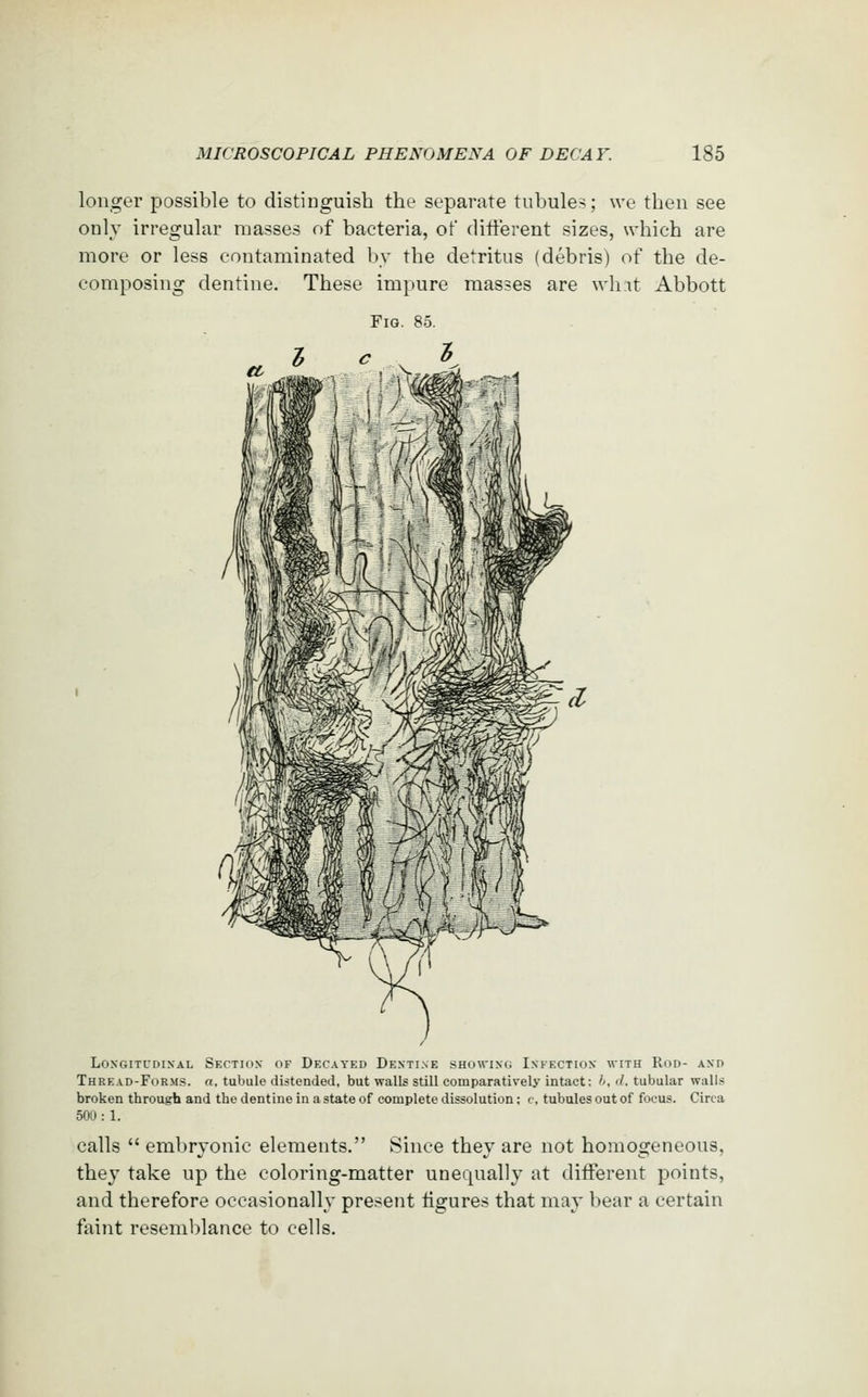 longer possible to distinguish the separate tubules; we then see only irregular masses of bacteria, of ditferent sizes, which are more or less contaminated l)v the detritus (debris) of the de- composing dentine. These impure masses are wh.it Abbott LOXGITUDIXAL SeCTIOX OF DECAYED DeXTI.VE SHOWING INFECTION WITH ROD- AND Thread-Forms, a, tubule distended, but walls still comparatively intact: h, d. tubular walls broken through and the dent ine in a state of complete dissolution ; c, tubules out of focus. Circa 500 : 1. calls  embryonic elements. Since they are not homogeneous, they take up the coloring-matter unequally at ditferent points, and therefore occasionally present ligures that may bear a certain faint resemblance to cells.