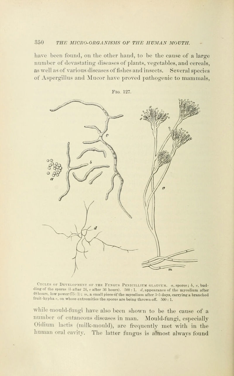 have been found, on the other hand, to be the canse of a large nnniber of devastating diseases of plants, vegetables, and cereals, as well as of various diseases of fishes and insects. Several species of Aspergilhis and Mncor have proved pathogenic to mammals. Fig. 127. Cyclus of Developmext op the FUxVGUS Pexicillium glaucum. a, spores; b, c, bud- ding of the spores (b after 24, c after 36 hours). 500 : 1. d, appearance of the mycelium after 48hours, low power (75:1); m, a small piece of the mycelium after .3-5 days, carrying a branched fruit-hypha e, on whose extremities the spores are being thrown oft. 500 : 1. while -mould-fungi have also been shown to be the cause of a number of cutaneous diseases in man. Mould-fungi, especially Oidium lactis (milk-mould), are frequently met with in the human oral cavity. The latter fungus is almost always found