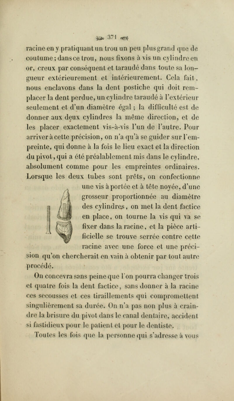 racinc en y pratiqiiant iin Irou un pen f)hisgrand (pie de coutume; dansce Irou, nous fixons a vis un cylindre en or, creux par consequent et taraude dans toute sa lon- gueur exterieurement et interieurement. Cela fait, nous enclavons dans la dent postiche qui doit rem- placer la dent perdue, un cylindre taraude a Textcrieur seulement et d'un diametre cgal; la difficullc est de donner aux deux cylindrcs la meme direction, et de les placer exactement vis-a-vis Tun de I'autre. Pour arriver a cette precision, on n'a qu'a se guider sur lem- preinte, qui donne a la fois le lieu exact et la direction du pivot, qui a ete prealablcment mis dans le cylindre, absolument comme pour les empreintes ordinaires. Lorsque les deux tubes sont prets, on confectionne une vis aportee et a tete noyee, d'une grosseur proportionnee au diametre des cylindros, on met la dent factice en place, on tourne la vis qui va se fixer dans la racinc, et la piece arti- ficielle se Irouve serrce centre cette racine avec une force et une preci- sion qu'on chercherait en vain a obtenir par tout autn^ precede. On concevra sans peine que Ion pourra changer trois et quatre fois la dent factice, sans donner a la racine ces secousses et ces tiraillements qui comprometlent singulierement sa dur(!;e. On n'a pas non plus a crain- dre la brisure du pivot dans le canal denlaire, accident si fastidicux pour le patient et pour le dentisto. Toutes les fois quo la porsonnequi s'adresso a v^mis