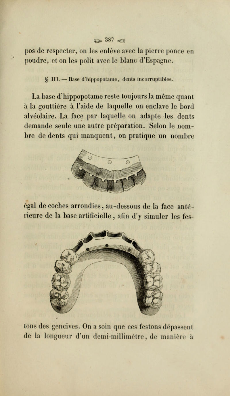 l>os de respecter, on les enleve avec la pierre ponce en poudre, et on les polit avec le blanc d'Espagne. ^ III. — Base (I'hippopotame, dents incorruptibles. La base d'hippopolame reste toujoursla m^me quant a la gouttiere a Taide de laquelle on enclave le bord alveolaire. La face par laquelle on adapte les dents demande seule une autre preparation. Selon le nom- bre de dents qui manquent, on pratique un nombre egal decoches arrondies, au-dessous de la face ante rieure de la base artificielle, afin d'y simuler les fes- tons des gencives. On a soin que ces festons depassenl de la longueur d'lm demi-inillinuMre, de nianiere u