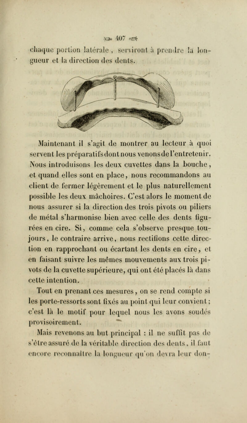 cliuquc porlion lalcrale , s(jr\iroiit a proiiilr gueur et la direction des dents. c la Ion Maintenant il s'agit de montrer au lectcur a quoi servent les preparatilsdontnous vcnonsderentretenir. Nous introduisons les deux cuvettes dans la bouclie, et quand eiles sont en place, nous recommandons au client de former legerement et le plus naturellement possible les deux machoires. Cost alors le moment de nous assurer si la direction des trois pivots ou piliers de metal s'harmonise Lien avec celle des dents figu- rees en cire. Si, comme cela s'observe presque tou- jours, le contraire arrive, nous rectilions cette direc- tion en rapprochant ou ecartant les dents en cire, et en faisant suivre les m6mes mouvements aux trois pi- vots de la cuvette superieure, qui ont ete places la dans cette intention. Tout en prenant ces mesures, on se rend coniple si les porte-ressorts sont fixes au point qui leur convient; c'est la le motif pour lequel nous les avons sondes provisoirement. ^ Mais revenons au but principal : il ne suffit pas de s'(}tr(i assure de la veritable direction d{}s denls, il I'aut en<'(U'e reconnalhr la loii^niMir (jn'on (h'Ma Irur don-