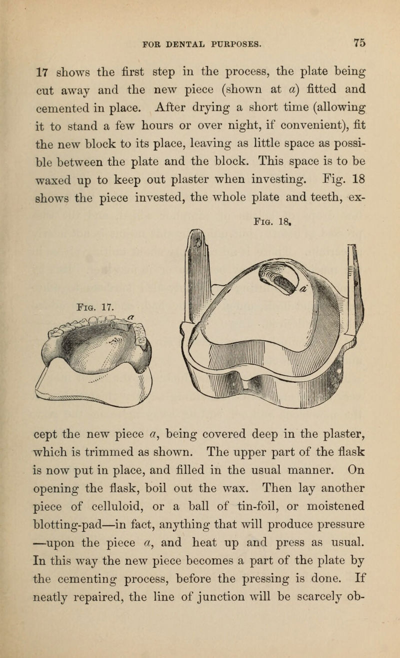 17 shows the first step in the process, the plate being cut away and the new piece (shown at a) fitted and cemented in place. After drying a short time (allowing it to stand a few hours or over night, if convenient), fit the new block to its place, leaving as little space as possi- ble between the plate and the block. This space is to be waxed up to keep out plaster when investing. Fig. 18 shows the piece invested, the whole plate and teeth, ex- FiG. 18. Fig. 17. cept the new piece a, being covered deep in the plaster, which is trimmed as shown. The upper part of the flask is now put in place, and filled in the usual manner. On opening the flask, boil out the wax. Then lay another piece of celluloid, or a ball of tin-foil, or moistened blotting-pad—in fact, anything that will produce pressure —upon the piece a, and heat up and press as usual. In this way the new piece becomes a part of the plate by the cementing process, before the pressing is done. If neatly repaired, the line of junction will be scarcely ob-
