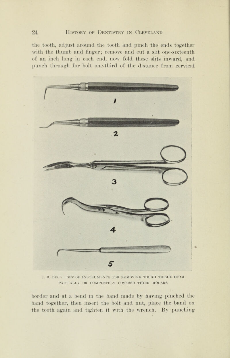the tooth, adjust ni'oiind the tooth and piiieh the ends together with the thumb and tinyer; remove and eut a slit one-sixteenth of an inch k)nii' in eaeh end, now fold these slits inward, and punch through for l)olt one-third of the distatiee from cervical J. R. BELL SET CF INSTRUMENTS FCR REMOVING TOUGH TISSUE FROM PARTIALLY OR COMPLETELY COVERED THIRD MOLARS border and at a bend in the band made by having pinched the band together, then insert the bolt and nut, place the band on the tooth again and tighten it with the wrench. By punching