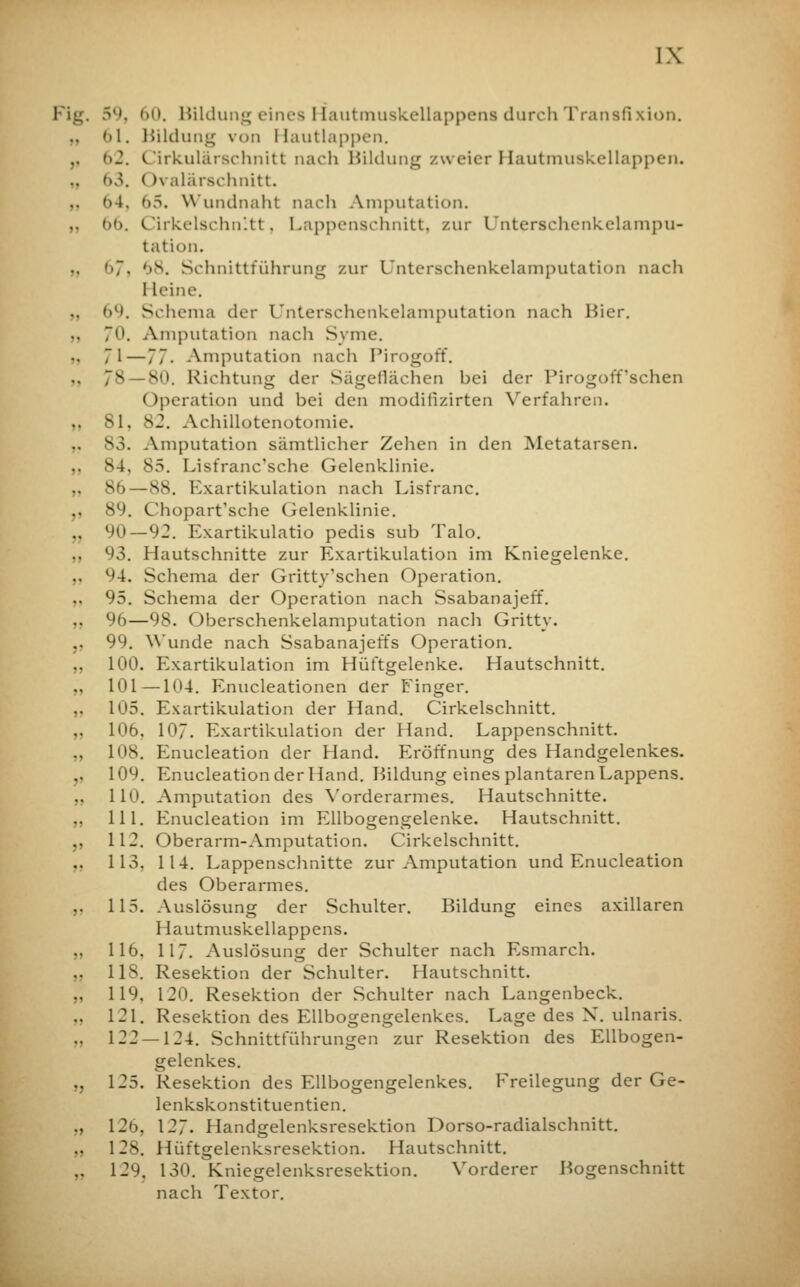 Fig. 59, 60. Bildung eines I lautmuskellappens durch Transfi xion. << 1. Bildung von I lautlappen. ,, (>2. Cirkulärschnitt nach Bildung zweier Hautmuskellappen. 63. < >\ alärschnitt. »>4. hr>. Wundnaht nach Amputation. 66. Cirkelschnltt, Lappenschnitt, zur Unterschenkelampu- tation. >>7. 68. Schnittführung zur Unterschenkelamputation nach I leine. <>l». Schema der Unterschenkelamputation nach Bier. 70. Amputation nach Syme. 71—77. Amputation nach Pirogoff. 7S— 80. Richtung der Sägeflächen hei der Pirogoff'sehen Operation und bei den modiiizirten Verfahren. 81, s2. Achiilotenotomie. 83. Amputation sämtlicher Zehen in den Metatarsen. 84, 85. Lisfranc'sche Gelenklinie. 86—88. Exartikulation nach Lisfranc. 89. Chopart'sche Gelenklinie. 90—92. Exartikulatio pedis sub Talo. 93. Hautschnitte zur Exartikulation im Kniegelenke. c'4. Schema der Gritty'schen Operation. 95. Schema der Operation nach Ssabanajeff. 96—98. Oberschenkelamputation nach Gritty. 99. Wunde nach Ssabanajeffs Operation. 100. Exartikulation im Hüftgelenke. Hautschnitt. 101—104. Enucleationen der Finger. ,. 105. Exartikulation der Hand. Cirkelschnitt. 106, 10. Exartikulation der Hand. Lappenschnitt. 108. Enucleation der Hand. Eröffnung des Handgelenkes. ,, 109. Enucleation der Hand. Bildung eines plantaren Lappens. 110. Amputation des Vorderarmes. Hautschnitte. 111. Enucleation im Ellbogengelenke. Hautschnitt. ,, 112. Oberarm-Amputation. Cirkelschnitt. 113, 114. Lappenschnitte zur Amputation und Enucleation des Oberarmes. .. 115. Auslösung der Schulter. Bildung eines axillaren 1 lautmuskellappens. ,, 116, 117. Auslösung der Schulter nach Esmarch. 118. Resektion der Schulter. Hautschnitt. 119, 120. Resektion der Schulter nach Langenbeck. .. 121. Resektion des Ellbogengelenkes. Lage des X. ulnaris. 122 — 124. Schnittführungen zur Resektion des Ellbogen- gelenkes. „ 125. Resektion des Ellbogengelenkes. Freilegung der Ge- lenkskonstituentien. „ 126, 127. Handgelenksresektion Dorso-radialschnitt. 128. Hüftgelenksresektion. Hautschnitt. 129. ISO. Kniegelenksresektion. Vorderer Bogenschnitt nach Textor.