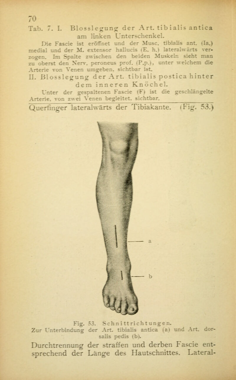 7 ~. I. Bio— g _ der A rt. tib i ali s antica am linken Unterschenkel. : Fasde I 5ffnet und der Muse, tibialis ant. da.) medial und der M. »r hallucis iE. h.) laterahvärts ver- Im Spalte zwischen den beiden Muskeln sieht man . peroneus prof. (P.p.), unter welchem die ::en umgeben. sichtbar ist. II. B1 sslegung der Art. tibialis postica hinter dem inneren Knöchel. tef iler gespaltenen F'ascie (F< ist die geschlängelte . htfaar. Querfinger laterahvärts der Tibiakante. »Fig. 53.) ■  - - 5 tt rieh tun gen. Zur Unterbindung der Art. tibialis antica (a> und Art. dor- salis pedis (b). Durchtrennung der straffen und derben Fascie ent- gehend der Länge des Hautschnittes. Lateral-