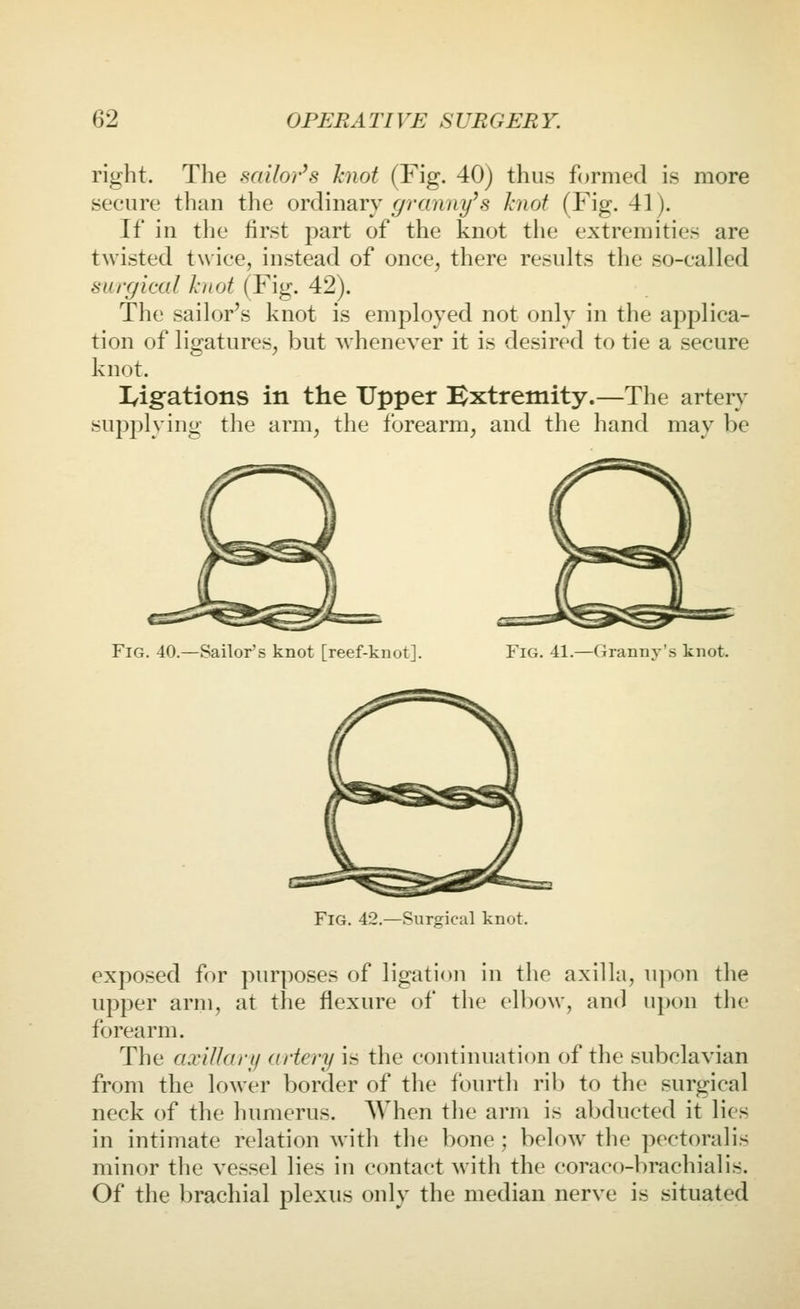 right. Tlie sailor^s knot (Fig. 40) thus fijrmed is more secure than the ordinary granny^s knot (Fig. 41). If in the first part of the knot the extremities are twisted twice, instead of once, there results the so-called surgical knot (Fig. 42). The sailor's knot is employed not only in the applica- tion of ligatures, but whenever it is desired to tie a secure knot. lyigations in the Upper Extremity.—The arter\^ supplyino' the arm, the forearm, and the hand may be Fig. 40.—Sailor's knot [reef-knot]. Fig. 41.—Granny's knot. Fig. 42.—Surgical knot. exposed for purposes of ligati<m in the axilla, upon the upper arm, at the flexure of the elbow, and upon the forearm. The axillary artery is the continuation of the subclavian from the lower border of the fourth ril) to the surgical neck of the humerus. When the arm is abducted it lies in intimate relation with the bone; below the pectoralis minor the vessel lies in contact with the coraco-brachialis. Of the brachial plexus only the median nerve is situated