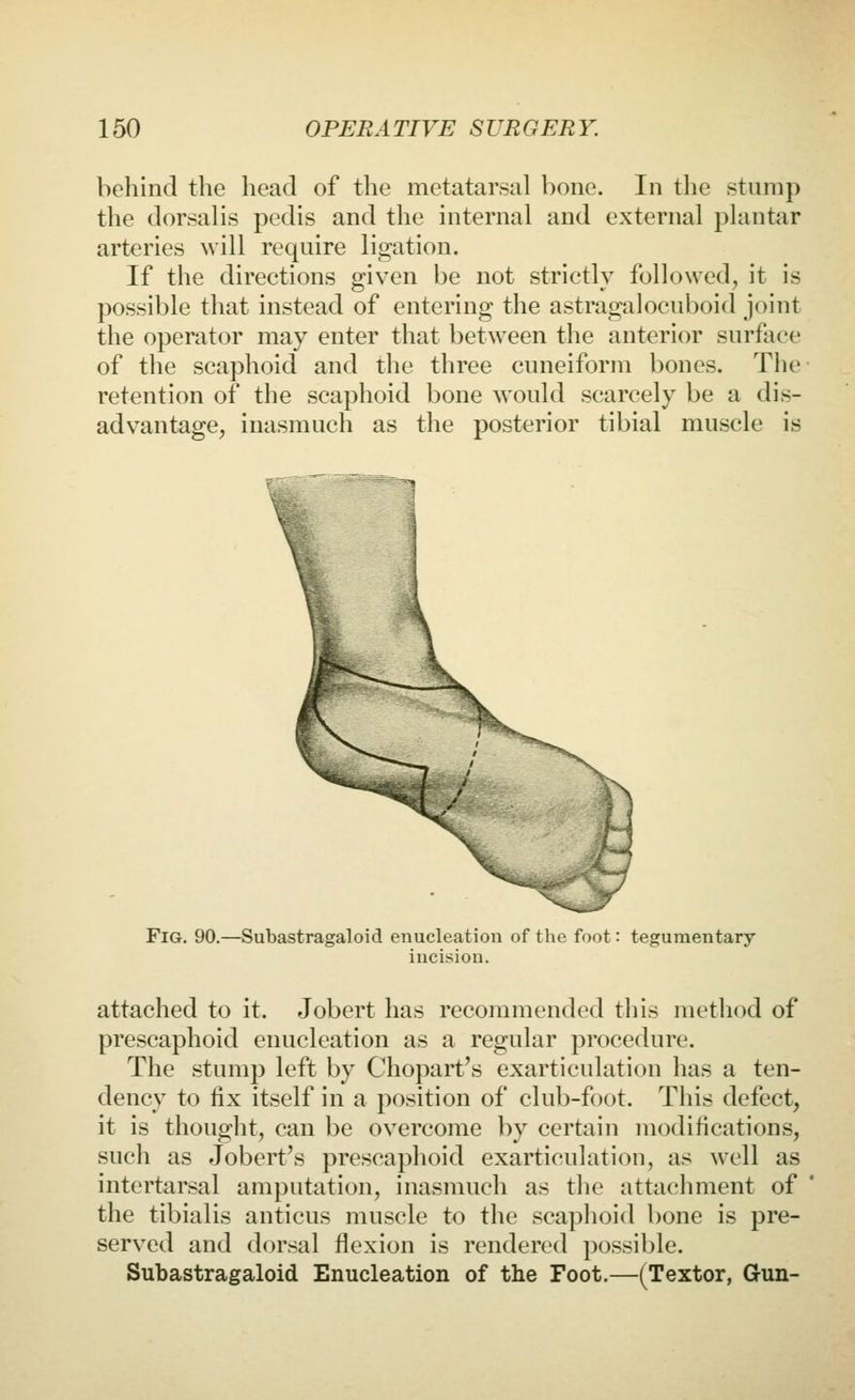 behind the head of the metatarsal bone. In the stamp the dorsalis pedis and the internal and external plantar arteries will require ligation. If the directions given be not strictly followed, it is possible that instead of entering the astragalocuboid joint the operator may enter that between the anterior surface of the scaphoid and the three cuneiform bones. The retention of the scaphoid bone would scarcely be a dis- advantage, inasmuch as the posterior tibial muscle is Fig. 90.—Subastragaloid enucleation of the foot: tegumentary incision. attached to it. Jobert has recommended this method of prescaphoid enucleation as a regular procedure. The stump left by Chopart's exarticulation has a ten- dency to fix itself in a position of club-foot. This defect, it is thought, can be overcome by certain modifications, such as Jobert's prescaphoid exarticulatiou, as well as intertarsal amputation, inasmuch as the attachment of the tibialis anticus muscle to the scaphoid bone is pre- served and dorsal flexion is rendered possible. Subastragaloid Enucleation of the Foot.—(Textor, Gun-