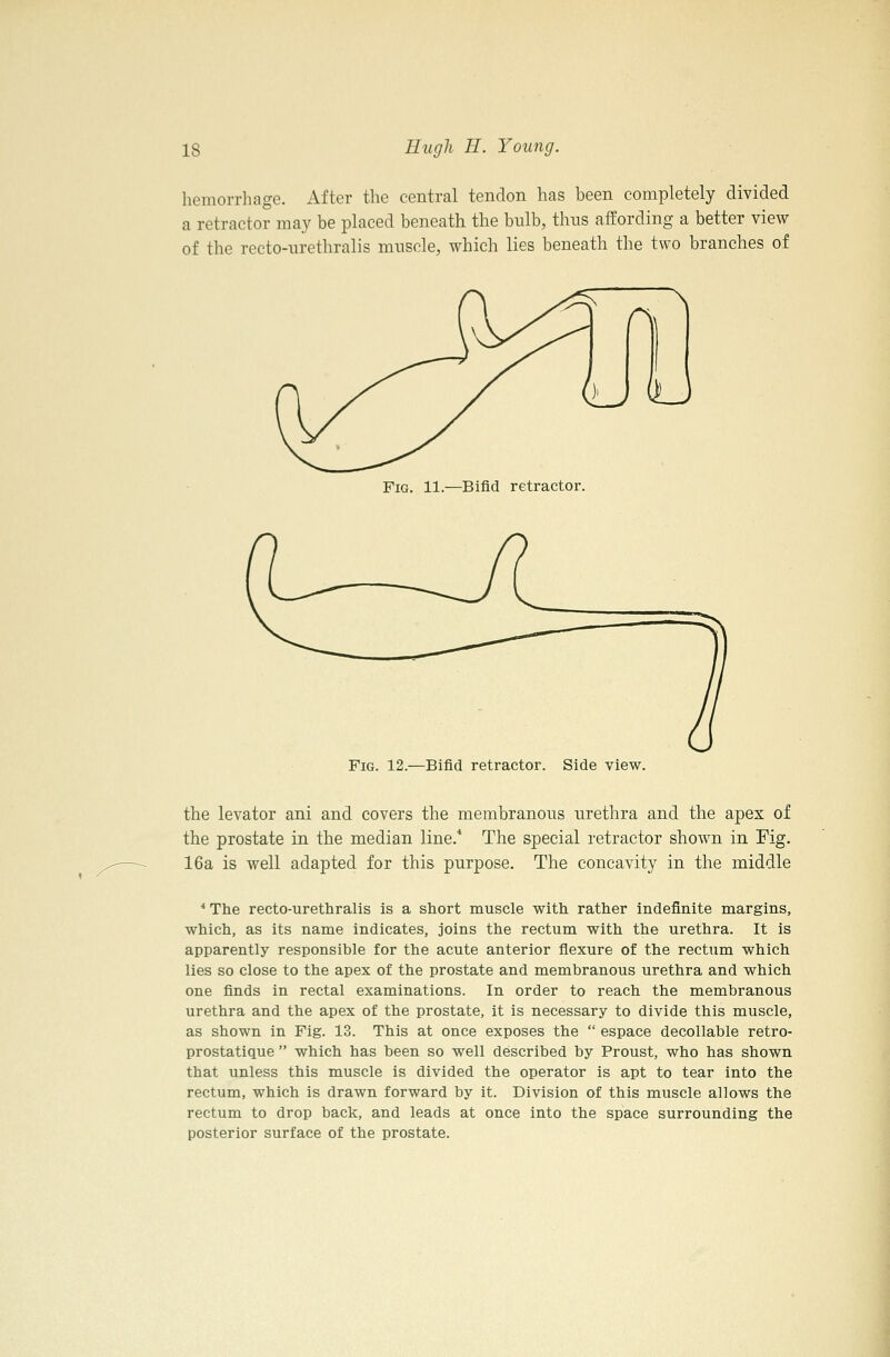 hemorrhage. After the central tendon has been completely divided a retractor may be placed beneath the bulb, thus affording a better view of the recto-urethralis muscle, which lies beneath the two branches of Fig. 11.—Bifid retractor. Fig. 12.—Bifid retractor. Side view. the levator ani and covers the membranous urethra and the apex of the prostate in the median line.* The special retractor shown in Fig. 16a is well adapted for this purpose. The concavity in the middle * The recto-urethralis is a short muscle with rather indefinite margins, which, as its name indicates, joins the rectum with the urethra. It is apparently responsible for the acute anterior flexure of the rectum which lies so close to the apex of the prostate and membranous urethra and which one finds in rectal examinations. In order to reach the membranous urethra and the apex of the prostate, it is necessary to divide this muscle, as shown in Fig. 13. This at once exposes the  espace decollable retro- prostatique  which has been so well described by Proust, who has shown that unless this muscle is divided the operator is apt to tear into the rectum, which is drawn forward by it. Division of this muscle allows the rectum to drop back, and leads at once into the space surrounding the posterior surface of the prostate.