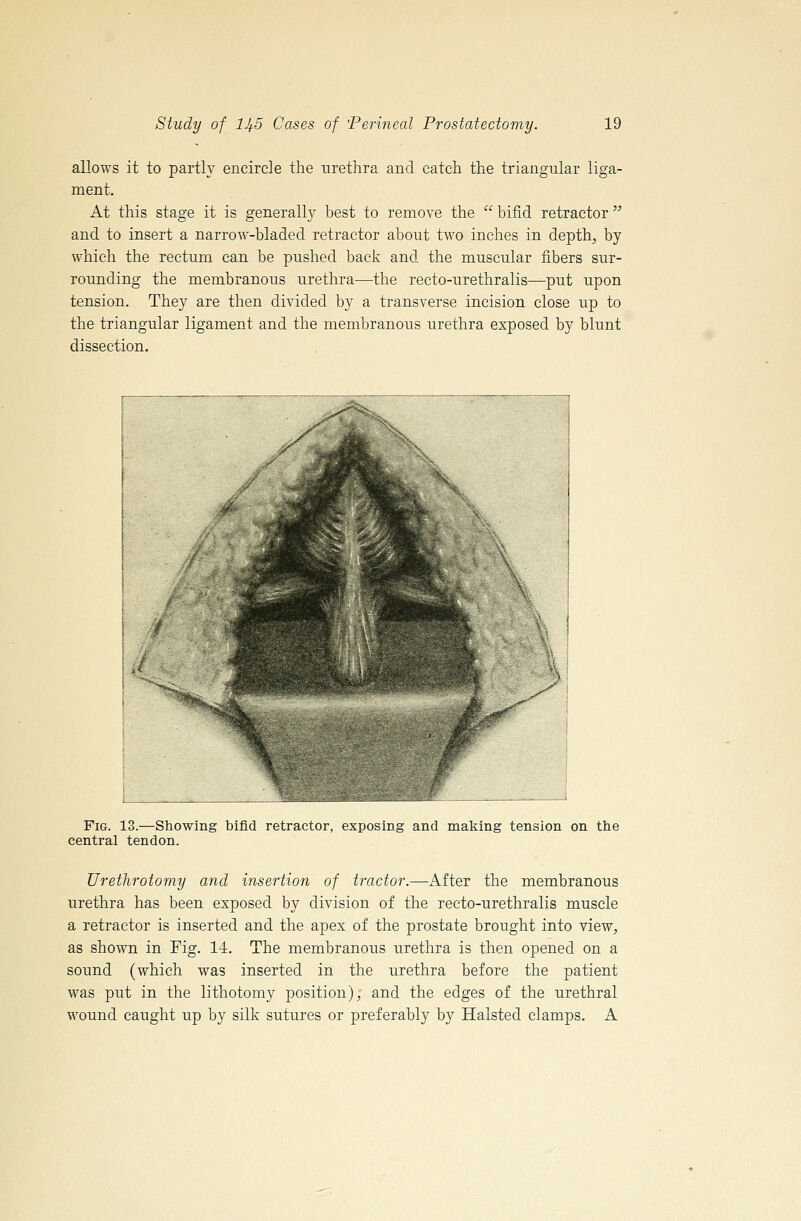 allows it to partly encircle the urethra and catch the triangular liga- ment. At this stage it is generally best to remove the  bifid retractor  and to insert a narrow-bladed retractor about two inches in depth, by which the rectum can be pushed back and the muscular fibers sur- rounding the membranous urethra—the recto-urethralis—put upon tension. They are then divided by a transverse incision close up to the triangular ligament and the membranous urethra exposed by blunt dissection. Fig. 13.—Showing bifid retractor, exposing and making tension on the central tendon. Uretlirotomy and insertion of tractor.—After the membranous urethra has been exposed by division of the recto-urethralis muscle a retractor is inserted and the apex of the prostate brought into view, as shown in Fig. 14. The membranous urethra is then opened on a sound (which was inserted in the urethra before the patient was put in the lithotomy position), and the edges of the urethral wound caught up by silk sutures or preferably by Halsted clamps. A