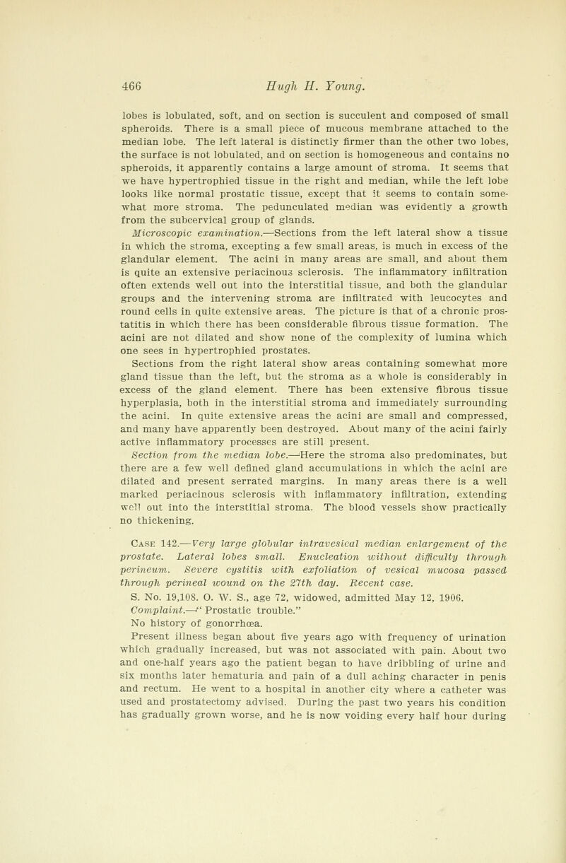lobes is lobulated, soft, and on section is succulent and composed of small spheroids. There is a small piece of mucous membrane attached to the median lobe. The left lateral is distinctly firmer than the other two lobes, the surface is not lobulated, and on section is homogeneous and contains no spheroids, it apparently contains a large amount of stroma. It seems that we have hypertrophied tissue in the right and median, while the left lobe looks like normal prostatic tissue, except that it seems to contain some- what more stroma. The pedunculated median was evidently a growth from the subcervical group of glands. Microscopic examination.—^Sections from the left lateral show a tissue in which the stroma, excepting a few small areas, is much in excess of the glandular element. The acini in many areas are small, and about them is quite an extensive periacinous sclerosis. The inflammatory infiltration often extends well out into the interstitial tissue, and both the glandular groups and the intervening stroma are infiltrated with leucocytes and round cells in quite extensive areas. The picture is that of a chronic pros- tatitis in which there has been considerable fibrous tissue formation. The acini are not dilated and show none of the complexity of lumina which one sees in hypertrophied prostates. Sections from the right lateral show areas containing somewhat more gland tissue than the left, but the stroma as a whole is considerably in excess of the gland element. There has been extensive fibrous tissue hyperplasia, both in the interstitial stroma and immediately surrounding the acini. In quite extensive areas the acini are small and compressed, and many have apparently been destroyed. About many of the acini fairly active infiammatory processes are still present. Section from the median lobe.—^Here the stroma also predominates, but there are a few well defined gland accumulations in which the acini are dilated and present serrated margins. In many areas there is a well marked periacinous sclerosis with infiammatory infiltration, extending well out into the interstitial stroma. The blood vessels show practically no thickening. Case 142.— Very large globular intravesical median enlargevient of the prostate. Lateral lobes small. Enucleation without difficulty through perineum. Severe cystitis with exfoliation of vesical mucosa passed through perineal wound on the 21th day. Recent case. S. No. 19,108. O. W. S., age 72, widowed, admitted May 12, 1906. Complaint.—f Prostatic trouble. No history of gonorrhoea. Present illness began about five years ago with frequency of urination which gradually increased, but was not associated with pain. About two and one-half years ago the patient began to have dribbling of urine and six months later hematuria and pain of a dull aching character in penis and rectum. He went to a hospital in another city where a catheter was used and prostatectomy advised. During the past two years his condition has gradually grown worse, and he is now voiding every half hour during