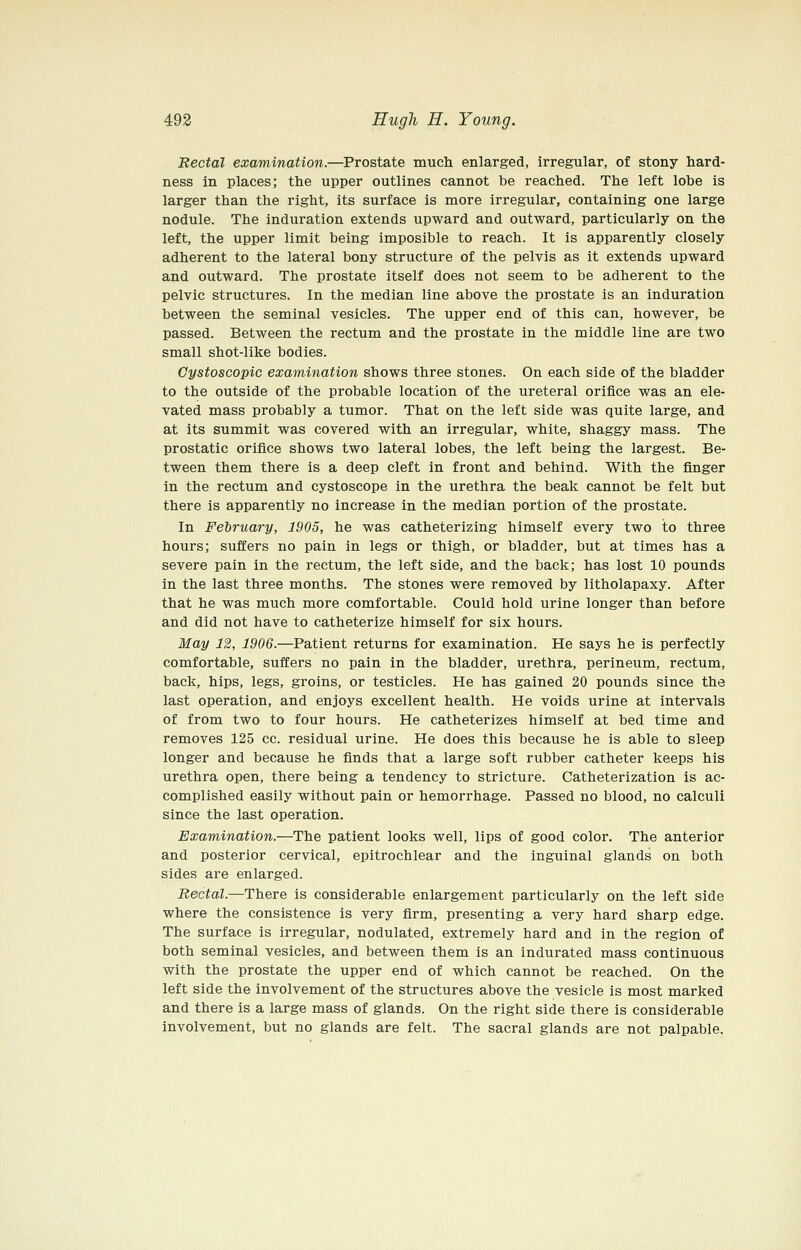 Rectal examination.—Prostate much enlarged, irregular, of stony hard- ness in places; the upper outlines cannot be reached. The left lobe is larger than the right, its surface is more irregular, containing one large nodule. The induration extends upward and outward, particularly on the left, the upper limit being imposible to reach. It is apparently closely adherent to the lateral bony structure of the pelvis as it extends upward and outward. The prostate itself does not seem to be adherent to the pelvic structures. In the median line above the prostate is an induration between the seminal vesicles. The upper end of this can, however, be passed. Between the rectum and the prostate in the middle line are two small shot-like bodies. Cystoscopic examination shows three stones. On each side of the bladder to the outside of the probable location of the ureteral orifice was an ele- vated mass probably a tumor. That on the left side was quite large, and at its summit was covered with an irregular, white, shaggy mass. The prostatic orifice shows two lateral lobes, the left being the largest. Be- tween them there is a deep cleft in front and behind. With the finger in the rectum and cystoscope in the urethra the beak cannot be felt but there is apparently no increase in the median portion of the prostate. In February, 1905, he was catheterizing himself every two to three hours; suffers no pain in legs or thigh, or bladder, but at times has a severe pain in the rectum, the left side, and the back; has lost 10 pounds in the last three months. The stones were removed by litholapaxy. After that he was much more comfortable. Could hold urine longer than before and did not have to catheterize himself for six hours. May 12, 1906.—Patient returns for examination. He says he is perfectly comfortable, suffers no pain in the bladder, urethra, perineum, rectum, back, hips, legs, groins, or testicles. He has gained 20 pounds since the last operation, and enjoys excellent health. He voids urine at intervals of from two to four hours. He catheterizes himself at bed time and removes 125 cc. residual urine. He does this because he is able to sleep longer and because he finds that a large soft rubber catheter keeps his urethra open, there being a tendency to stricture. Catheterization is ac- complished easily without pain or hemorrhage. Passed no blood, no calculi since the last operation. Examination.—The patient looks well, lips of good color. The anterior and posterior cervical, epitrochlear and the inguinal glands on both sides are enlarged. Rectal.—There is considerable enlargement particularly on the left side where the consistence is very firm, presenting a very hard sharp edge. The surface is irregular, nodulated, extremely hard and in the region of both seminal vesicles, and between them is an indurated mass continuous with the prostate the upper end of which cannot be reached. On the left side the involvement of the structures above the vesicle is most marked and there is a large mass of glands. On the right side there is considerable involvement, but no glands are felt. The sacral glands are not palpable.