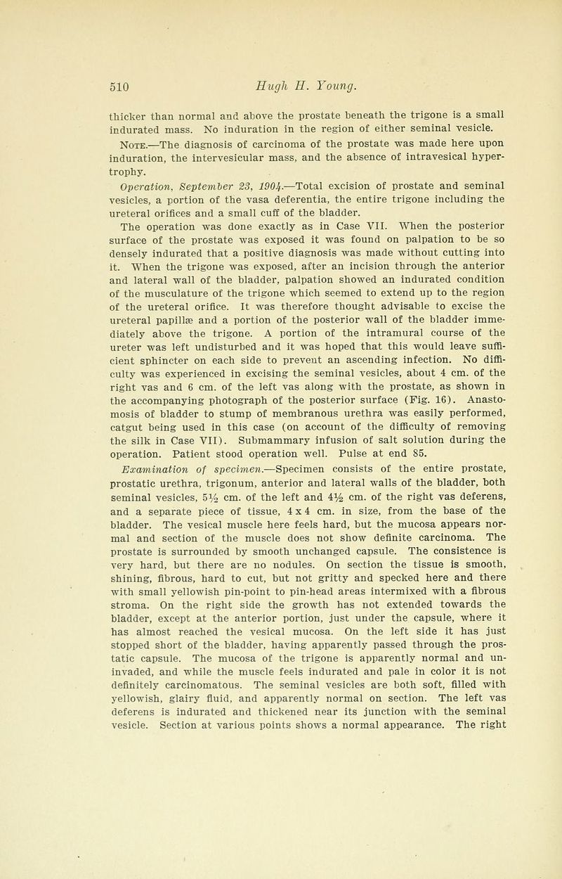 thicker than normal and above the prostate beneath the trigone is a small indurated mass. No induration in the region of either seminal vesicle. Note.—The diagnosis of carcinoma of the prostate was made here upon induration, the intervesicular mass, and the absence of intravesical hyper- trophy. Operation, September 23, 1904.—Total excision of prostate and seminal vesicles, a portion of the vasa deferentia, the entire trigone including the ureteral orifices and a small cuff of the bladder. The operation was done exactly as in Case VII. When the posterior surface of the prostate was exposed it was found on palpation to be so densely indurated that a positive diagnosis was made without cutting into it. When the trigone was exposed, after an incision through the anterior and lateral wall of the bladder, palpation showed an indurated condition of the musculature of the trigone which seemed to extend up to the region of the ureteral orifice. It was therefore thought advisable to excise the ureteral papillae and a portion of the posterior wall of the bladder imme- diately above the trigone. A portion of the intramural course of the ureter was left undisturbed and it was hoped that this would leave suffi- cient sphincter on each side to prevent an ascending infection. No diffi- culty was experienced in excising the seminal vesicles, about 4 cm. of the right vas and 6 cm. of the left vas along with the prostate, as shown in the accompanying photograph of the posterior surface (Fig. 16). Anasto- mosis of bladder to stump of membranous urethra was easily performed, catgut being used in this case (on account of the difficulty of removing the silk in Case VII). Submammary infusion of salt solution during the operation. Patient stood operation well. Pulse at end 85. Examination of specimen.—Specimen consists of the entire prostate, prostatic urethra, trigonum, anterior and lateral walls of the bladder, both seminal vesicles, 514 cm. of the left and 4% cm. of the right vas deferens, and a separate piece of tissue, 4x4 cm. in size, from the base of the bladder. The vesical muscle here feels hard, but the mucosa appears nor- mal and section of the muscle does not show definite carcinoma. The prostate is surrounded by smooth unchanged capsule. The consistence is very hard, but there are no nodules. On section the tissue is smooth, shining, fibrous, hard to cut, but not gritty and specked here and there with small yellowish pin-point to pin-head areas intermixed with a fibrous stroma. On the right side the growth has not extended towards the bladder, except at the anterior portion, just under the capsule, where it has almost reached the vesical mucosa. On the left side it has just stopped short of the bladder, having apparently passed through the pros- tatic capsule. The mucosa of the trigone is apparently normal and un- invaded, and while the muscle feels indurated and pale in color it is not definitely carcinomatous. The seminal vesicles are both soft, filled with yellowish, glairy fluid, and apparently normal on section. The left vas deferens is indurated and thickened near its junction with the seminal vesicle. Section at various points shows a normal appearance. The right