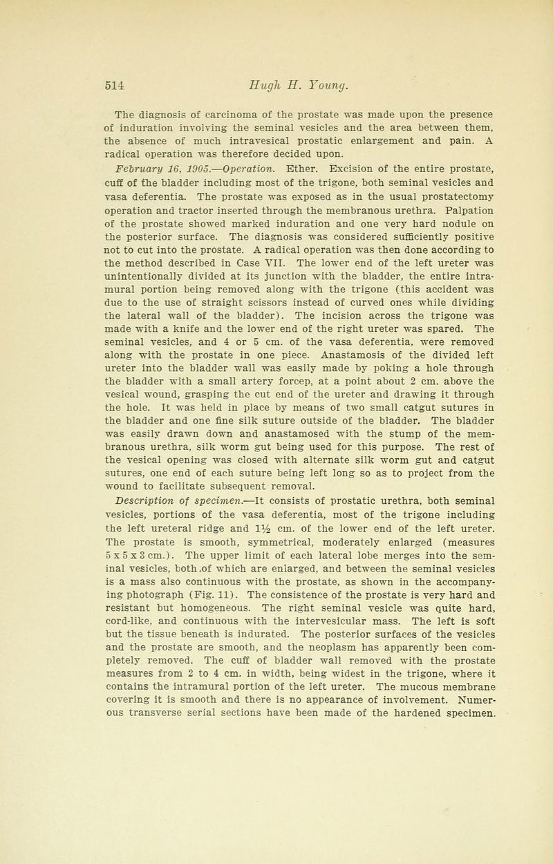 The diagnosis of carcinoma of the prostate was made upon the presence of induration involving the seminal vesicles and the area between them, the absence of much intravesical prostatic enlargement and pain. A radical operation was therefore decided upon. February 16, 1905.—Operation. Ether. Excision of the entire prostaie, cuff of ttie bladder including most of the trigone, both seminal vesicles and vasa deferentia. The prostate was exposed as in the usual prostatectomy operation and tractor inserted through the membranous urethra. Palpation of the prostate showed marked induration and one very hard nodule on the posterior surface. The diagnosis was considered sufficiently positive not to cut into the prostate. A radical operation was then done according to the method described in Case VII. The lower end of the left ureter was unintentionally divided at its junction with the bladder, the entire intra- mural portion being removed along with the trigone (this accident was due to the use of straight scissors instead of curved ones while dividing the lateral wall of the bladder). The incision across the trigone was made with a knife and the lower end of the right ureter was spared. The seminal vesicles, and 4 or 5 cm. of the vasa deferentia, were removed along with the prostate in one piece. Anastamosis of the divided left ureter into the bladder wall was easily made by poking a hole through the bladder with a small artery forcep, at a point about 2 cm. above the vesical wound, grasping the cut end of the ureter and drawing it through the hole. It was held in place by means of two small catgut sutures in the bladder and one fine silk suture outside of the bladder. The bladder was easily drawn down and anastamosed with the stump of the mem- branous urethra, silk worm gut being used for this purpose. The rest of the vesical opening was closed with alternate silk worm gut and catgut sutures, one end of each suture being left long so as to project from the wound to facilitate subsequent removal. Description of specimen.—It consists of prostatic urethra, both seminal vesicles, portions of the vasa deferentia, most of the trigone including the left ureteral ridge and 1% cm. of the lower end of the left ureter. The prostate is smooth, symmetrical, moderately enlarged (measures 5x5x3 cm.). The upper limit of each lateral lobe merges into the sem- inal vesicles, both .of which are enlarged, and between the seminal vesicles is a mass also continuous with the prostate, as shown in the accompany- ing photograph (Fig. 11). The consistence of the prostate is very hard and resistant but homogeneous. The right seminal vesicle was quite hard, cord-like, and continuous with the intervesicular mass. The left is soft but the tissue beneath is indurated. The posterior surfaces of the vesicles and the prostate are smooth, and the neoplasm has apparently been com- pletely removed. The cuff of bladder wall removed with the prostate measures from 2 to 4 cm. in width, being widest in the trigone, where it contains the intramural portion of the left ureter. The mucous membrane covering it is smooth and there is no appearance of involvement. Numer- ous transverse serial sections have been made of the hardened specimen.