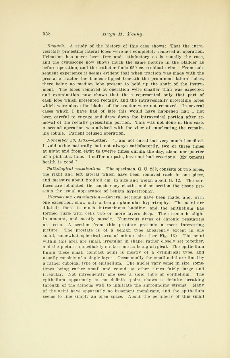 Remark.—A study of the history of this case shows: That the intra- vesically projecting lateral lobes were not completely removed at operation. Urination has never been free and satisfactory as is usually the case, and the cystoscope now shows much the same picture in the bladder as before operation, and the catheter finds 650 cc. residual urine. From sub- sequent experience it seems evident that when traction was made with the prostatic tractor the blades slipped beneath the prominent lateral lobes, there being no median lobe present to hold up the shaft of the instru- ment. The lobes removed at operation were smaller than was expected, and examination now shows that these represented only that part of each lobe which presented rectally, and the intravesically projecting lobes which were above the blades of the tractor were not removed. In several cases which I have had of late this would have happened had I not been careful to engage and draw down the intravesical portion after re- moval of the rectally presenting portion. This was not done in this case. A second operation was advised with the view of enucleating the remain- ing lobule. Patient refused operation. November 30, 1905.—Letter.  I am not cured but very much benefited. I void urine naturally but not always satisfactorily, two or three times at night and from eight to twelve times during the day, about one-quarter of a pint at a time. I suffer no pain, have not had erections. My general health is good. Pathological examination.—The specimen, G. U. 232, consists of two lobes, the right and left lateral which have been removed each in one piece, and measure about 2x3x3 cm. in size and weigh about G. 12. The sur- faces are lobulated, the consistency elastic, and on section the tissue pre- sents the usual appearance of benign hypertrophy. Microscopic examination.—Several sections have been made, and, with one exception, show only a benign glandular hypertrophy. The acini are dilated; there is much intraacinous budding, and the epithelium has formed rugae with cells two or more layers deep. The stroma is slight in amount, and mostly muscle. Numerous areas of chronic prostatitis are seen. A section from this prostate presents a most interesting picture. The prostate is of a benign type apparently except in one small, somewhat spherical area of minute size (see Fig. 16). The acini within this area are small, irregular in shape, rather closely set together, and the picture immediately strikes one as being atypical. The epithelium lining these small compact acini is mostly of a cylindrical type, and usually consists of a single layer. Occasionally the small acini are lined by a rather cuboidal type of epithelium. The nuclei vary some in size, some- times being rather small and round, at other times fairly large and irregular. Not infrequently one sees a solid tube of epithelium. The epithelium apparently at no definite point shows a definite breaking through of the acinous wall to infiltrate the surrounding stroma. Many of the acini have apparently no basement membrane, and the epithelium seems to line simply an open space. About the periphery of this small