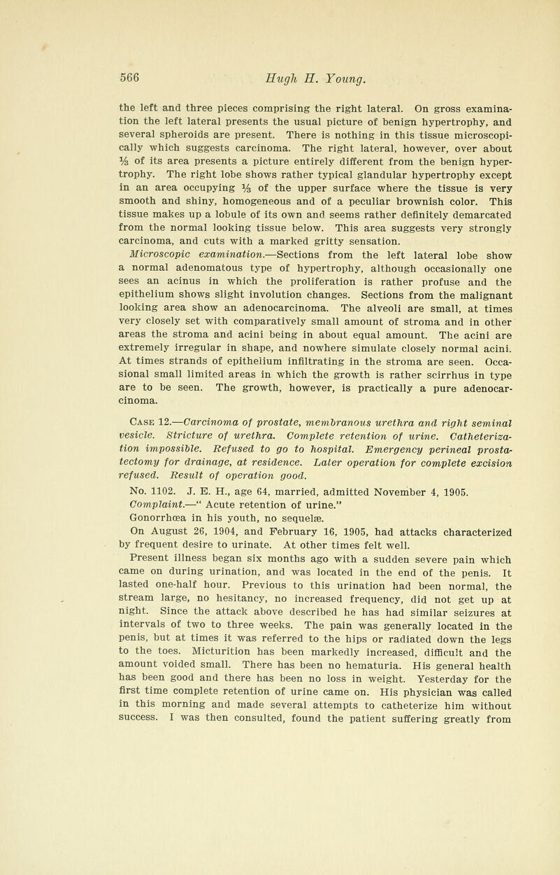 the left and three pieces comprising the right lateral. On gross examina- tion the left lateral presents the usual picture of benign hypertrophy, and several spheroids are present. There is nothing in this tissue microscopi- cally which suggests carcinoma. The right lateral, however, over about % of its area presents a picture entirely different from the benign hyper- trophy. The right lobe shows rather typical glandular hypertrophy except in an area occupying % of the upper surface where the tissue is very smooth and shiny, homogeneous and of a peculiar brownish color. This tissue makes up a lobule of its own and seems rather definitely demarcated from the normal looking tissue below. This area suggests very strongly carcinoma, and cuts with a marked gritty sensation. Microscopic examination.—Sections from the left lateral lobe show a normal adenomatous type of hypertrophy, although occasionally one sees an acinus in which the proliferation is rather profuse and the epithelium shows slight involution changes. Sections from the malignant looking area show an adenocarcinoma. The alveoli are small, at times very closely set with comparatively small amount of stroma and in other areas the stroma and acini being in about equal amount. The acini are extremely irregular in shape, and nowhere simulate closely normal acini. At times strands of epithelium infiltrating in the stroma are seen. Occa- sional small limited areas in which the growth is rather scirrhus in type are to be seen. The growth, however, is practically a pure adenocar- cinoma. Case 12.—Carcinoma of prostate, membranous urethra and right seminal vesicle. Stricture of urethra. Complete retention of urine. Catheteriza- tion impossible. Refused to go to hospital. Emergency perineal prosta- tectomy for drainage, at residence. Later operation for complete excision refused. Result of operation good. No. 1102. J. E. H., age 64, married, admitted November 4, 1905. Complaint.— Acute retention of urine. Gonorrhoea in his youth, no sequelae. On August 26, 1904, and February 16, 1905, had attacks characterized by frequent desire to urinate. At other times felt well. Present illness began six months ago with a sudden severe pain which came on during urination, and was located in the end of the penis. It lasted one-half hour. Previous to this urination had been normal, the stream large, no hesitancy, no increased frequency, did not get up at night. Since the attack above described he has had similar seizures at intervals of two to three weeks. The pain was generally located in the penis, but at times it was referred to the hips or radiated down the legs to the toes. Micturition has been markedly increased, difficult and the amount voided small. There has been no hematuria. His general health has been good and there has been no loss in weight. Yesterday for the first time complete retention of urine came on. His physician was called in this morning and made several attempts to catheterize him without success. I was then consulted, found the patient suffering greatly from