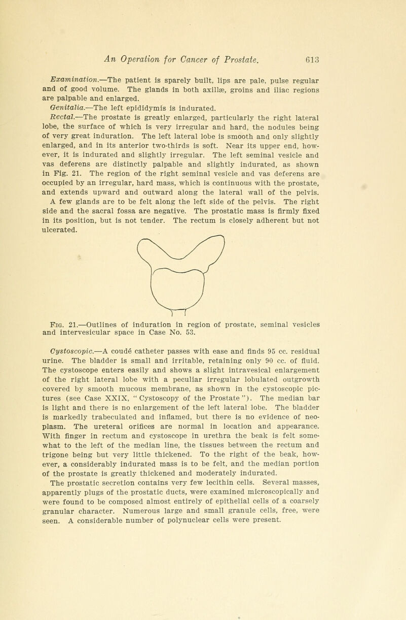 Examination.—The patient is sparely built, lips are pale, pulse regular and of good volume. The glands in both axillae, groins and iliac regions are palpable and enlarged. Genitalia.—The left epididymis is indurated. Rectal.—The prostate is greatly enlarged, particularly the right lateral lobe, the surface of which is very irregular and hard, the nodules being of very great induration. The left lateral lobe is smooth and only slightly enlarged, and in its anterior two-thirds is soft. Near its upper end, how- ever, it is indurated and slightly irregular. The left seminal vesicle and vas deferens are distinctly palpable and slightly indurated, as shown in Fig. 21. The region of the right seminal vesicle and vas deferens are occupied by an irregular, hard mass, which is continuous with the prostate, and extends upward and outward along the lateral wall of the pelvis. A few glands are to be felt along the left side of the pelvis. The right side and the sacral fossa are negative. The prostatic mass is firmly fixed in its position, but is not tender. The rectum is closely adherent but not ulcerated. Fig. 21.—Outlines of induration in region of prostate, seminal vesicles and intervesicular space in Case No. 53. Cystoscopic.—A coude catheter passes with ease and finds 95 cc. residual urine. The bladder is small and irritable, retaining only 90 cc. of fluid. The cystoscope enters easily and shows a slight intravesical enlargement of the right lateral lobe with a peculiar irregular lobulated outgrowth covered by smooth mucous membrane, as shown in the cystoscopic pic- tures (see Case XXIX, Cystoscopy of the Prostate). The median bar is light and there is no enlargement of the left lateral lobe. The bladder is markedly trabeculated and inflamed, but there is no evidence of neo- plasm. The ureteral orifices are normal in location and appearance. With finger in rectum and cystoscope in urethra the beak is felt some- what to the left of the median line, the tissues between the rectum and trigone being but very little thickened. To the right of the beak, how- ever, a considerably indurated mass is to be felt, and the median portion of the prostate is greatly thickened and moderately indurated. The prostatic secretion contains very few lecithin cells. Several masses, apparently plugs of the prostatic ducts, were examined microscopically and were found to be composed almost entirely of epithelial cells of a coarsely granular character. Numerous large and small granule cells, free, were seen. A considerable number of polynuclear cells were present.