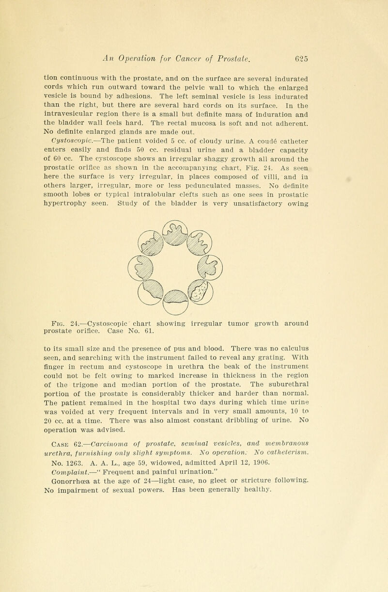 tion continuous with the prostate, and on the surface are several indurated cords which run outward toward the pelvic wall to which the enlarged vesicle is bound by adhesions. The left seminal vesicle is less indurated than the right, but there are several hard cords on its surface. In the intravesicular region there is a small but definite mass of induration and the bladder wall feels hard. The rectal mucosa is soft and not adherent. No definite enlarged glands are made out. Cystoscopic.—The patient voided 5 cc. of cloudy urine. A coude catheter enters easily and finds 50 cc. residual urine and a bladder capacity of 60 cc. The cystoscope shows an irregular shaggy growth all around the prostatic orifice as shown in the accompanying chart, Pig. 24. As seen here .the surface is very irregular, in places composed of villi, and in others larger, irregular, more or less pedunculated masses. No definite smooth lobes or typical intralobular clefts such as one sees in prostatic hypertrophy seen. Study of the bladder is very unsatisfactory owing Fig. 24.—Cystoscopic chart showing irregular tumor growth around prostate orifice. Case No. 61. to its small size and the presence of pus and blood. There was no calculus seen, and searching with the instrument failed to reveal any grating. With finger in rectum and cystoscope in urethra the beak of the instrument could not be felt owing to marked increase in thickness in the region of the trigone and median portion of the prostate. The suburethral portion of the prostate is considerably thicker and harder than normal. The patient remained in the hospital two days during which time urine was voided at very frequent intervals and in very small amounts, 10 to 20 cc. at a time. There was also almost constant dribbling of urine. No operation was advised. Case 62.—Carcinoma of prostate, seminal vesicles, and memtranous urethra, furnishing only slight symptoms. No operation: No catheterism. No. 1263. A. A. L., age 59, widowed, admitted April 12, 1906. Complaint.— Frequent and painful urination. Gonorrhoea at the age of 24—light case, no gleet or stricture following. No impairment of sexual powers. Has been generally healthy.