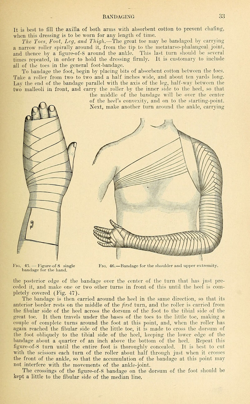 It is best to fill the axilla of both arms with absorbent cotton to prevent chafing, when this dressing is to be worn for any length of time. The Toes, Foot, Leg, and Thigh.—The great toe may be bandaged by carrying a narrow roller spirally around it, from the tip to the metatarso-phalangeal joint, and thence by a figure-of-8 around the ankle. This last turn should be several times repeated, in order to hold the dressing firmly. It is customary to include all of the toes in the general foot-bandage. To bandage the foot, begin by placing bits of absorbent cotton between the toes. Take a roller from two to two and a half inches wide, and about ten yards long. Lay the end of the bandage parallel with the axis of the leg, half-way between the two malleoli in front, and carry the roller by the inner side to the heel, so that the middle of the bandage will be over the center of the heel's convexity, and on to the starting-point. Next, make another turn around tlie ankle, carrying Fig. 45. — Figure-of-8 single bandage for the liand. Fig. 46.—Bandage for tlie slioulder and upper extremity. the posterior edge of the bandage over the center of the turn that has just pre- ceded it, and make one or two other turns in front of this until the heel is com- pletely covered (Fig. 47). The bandage is then carried around the heel in the same direction, so that its anterior border rests on tlie middle of the first turn, and the roller is carried from the fibular side of the heel across the dorsum of the foot to the tibial side of the great toe. It then travels under the bases of the toes to the little toe, making a couple of complete turns around the foot at this point, and, when the roller has again reached the fibular side of the little toe, it is made to cross the dorsum of the foot obliquely to the tibial side of the heel, keeping the lower edge of the bandage about a quarter of an inch above the bottom of the heel. Eepeat this figure-of-8 turn nntil the entire foot is thoroughly concealed. It is best to cut with the scissors each turn of the roller about half through just when it crosses the front of the ankle, so that the accumulation of the bandage at this point may not interfere with the movements of the ankle-joint. The crossings of the figure-of-8 bandage on the dorsum of the foot should be kept a little to the fibular side of the median line.