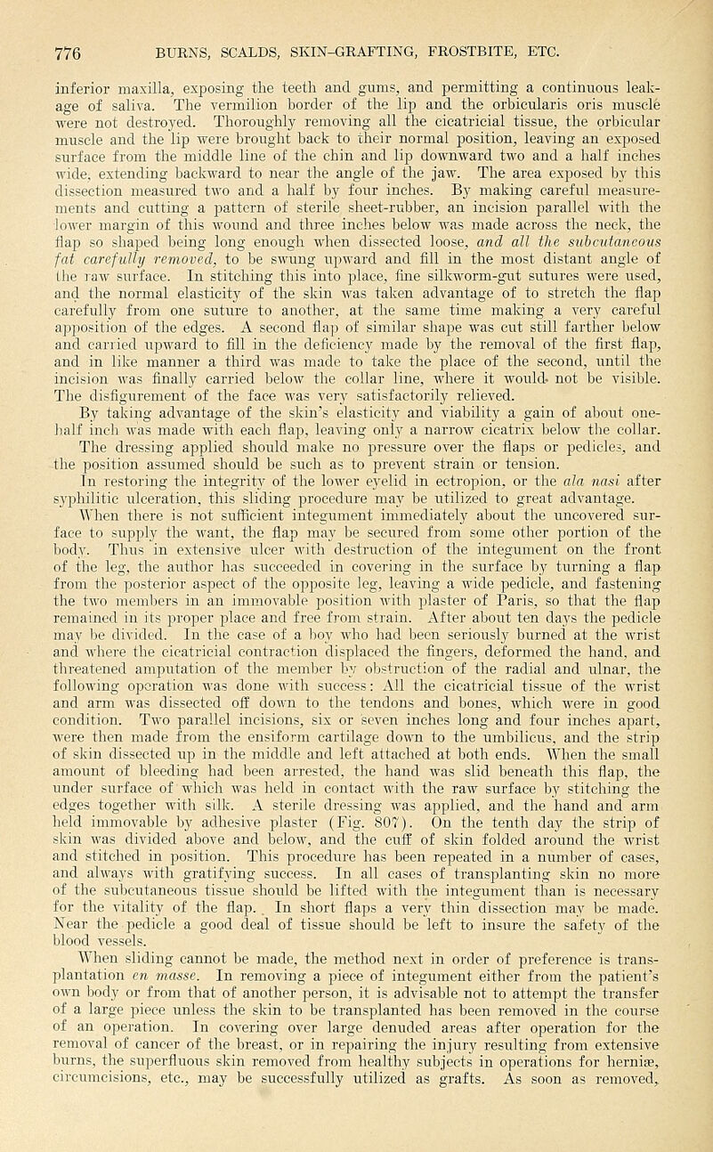 inferior maxilla, exposing the teeth and gums, and permitting a continuous leak- age of saliva. The vermilion border of the lip and the orbicularis oris muscle were not destroyed. Thoroughly removing all the cicatricial tissue, the orbicular muscle and the lip were brought back to their normal position, leaving an exposed surface from the middle line of the chin and lip downward two and a half inches wide, extending backward to near the angle of the jaw. The area exposed by this dissection measured two and a half by four inches. By making careful measure- ments and cutting a piattern of sterile sheet-rubber, an incision parallel with the lower margin of this wound and three inches below was made across the neck, the flap so shaped being long enough when dissected loose, and all the subcutaneous fat carefully removed, to be swung upward and fill in the most distant angle of the raw surface. In stitching this into place, fine silkworm-gut sutures were used, and the normal elasticity of the skin was taken advantage of to stretch the flap carefully from one suture to another, at the same time making a very careful apposition of the edges. A second flap of similar shape was cut still farther below and carried upward to fill in the deficiency made by the removal of the first flap, and in like manner a third was made to take the place of the second, until the incision was finally carried below the collar line, where it would- not be visible. The disfigurement of the face was very satisfactorily relieved. By taking advantage of the skin's elasticity and viability a gain of about one- hnli inch was made with each flap, leaving only a narrow cicatrix below the collar. The dressing applied should make no jjressure over the flaps or pedicles, and the position assumed should be such as to prevent strain or tension. Tn restoring the integrity of the lower eyelid in ectropion, or the ala nasi after syphilitic ulceration, this sliding procedure may be utilized to great advantage. When there is not sufficient integument immediately about the uncovered sur- face to supply the want, the flap may be secured from some other portion of the body. Thus in extensive ulcer with destruction of the integument on the front of the leg, the author has succeeded in covering in the surface by turning a flap from the posterior aspect of the opposite leg, leaving a wide pedicle, and fastening the tfl-o members in an immovable position with plaster of Paris, so that the flap remained in its proper place and free from strain. After about ten days the pedicle may be divided. In the case of a l)oy who had been seriously burnecl at the wrist and where the cicatricial contraction displaced the fingers, deformed the hand, and threatened amputation of the member by obstruction of the radial and ulnar, the following operation was done with success: All the cicatricial tissue of the wrist and arm was dissected off down to the tendons and bones, which were in good condition. Two parallel incisions, six or seven inches long and four inches apart, were then made from the ensiform cartilage do^\'n to the umbilicus, and the strip of skin dissected up in the middle and left attached at both ends. When the small amount of bleeding had been arrested, the hand was slid beneath this flap, the under surface of which was held in contact with the raw surface by stitching the edges together with silk. A sterile dressing was applied, and the hand and arm held immovable by adhesive plaster (Fig. 807). On the tenth day the strip of skin was divided above and below, and the cufl: of skin folded around the wrist and stitched in position. This procedure has been repeated in a number of cases, and always with gratifying success. In all cases of transplanting skin no more of the subcutaneous tissue should be lifted with the integument than is necessary for the vitality of the flap. . In short flaps a very thin dissection may be made. Near the pedicle a good deal of tissue should be left to insure the safety of the blood vessels. When sliding cannot be made, the method next in order of preference is trans- plantation en masse. In removing a piece of integument either from the patient's own body or from that of another person, it is advisable not to attempt the transfer of a large piece unless the skin to be transplanted has been removed in the course of an operation. In covering over large denuded areas after operation for the removal of cancer of the breast, or in repairing the injury resulting from extensive burns, the superfluous skin removed from healthy subjects in operations for hernise, circumcisions, etc., may be successfully utilized as grafts. As soon as removed.