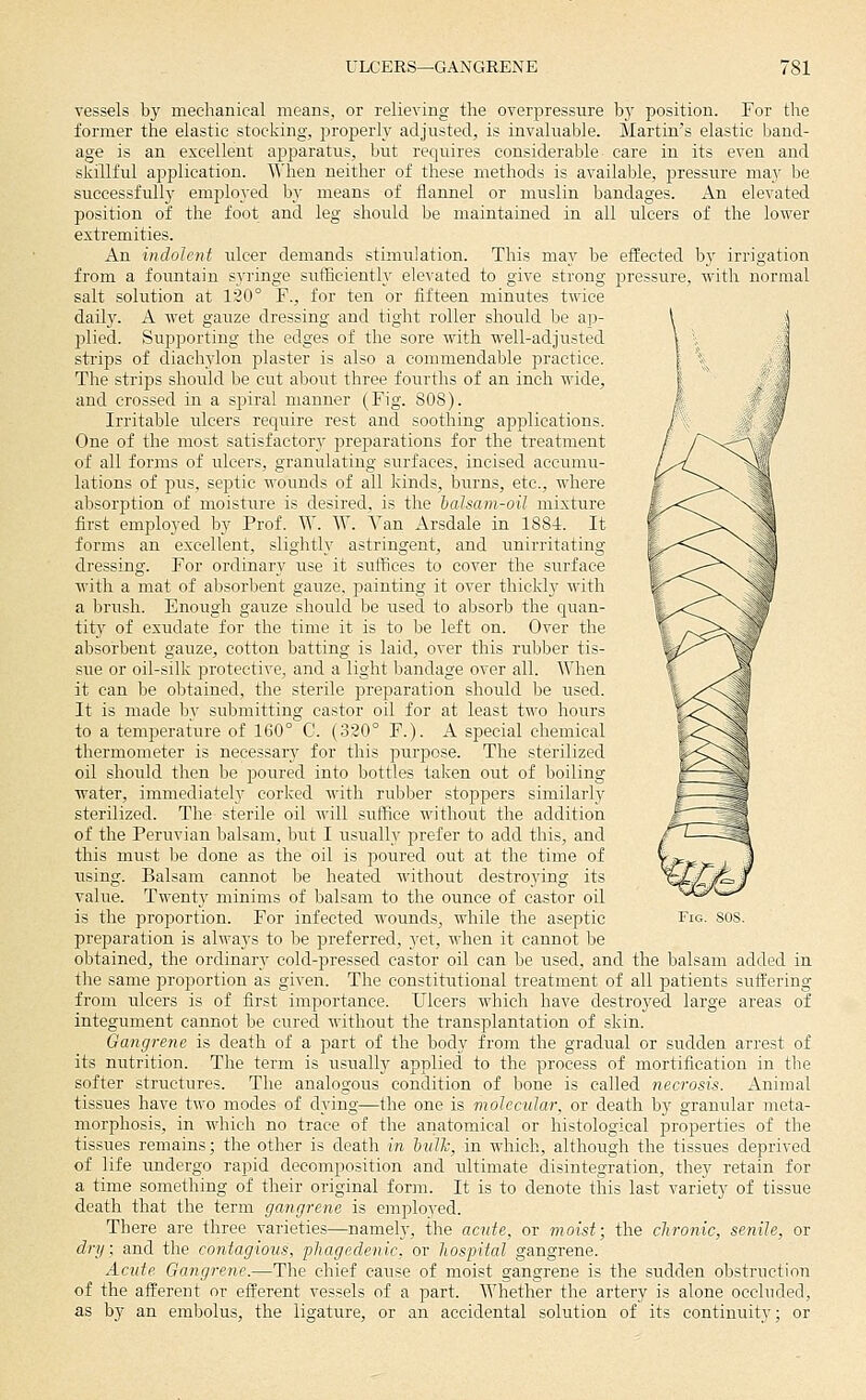 vessels by mechanical means, or relieving the overpressure bj^ position. For the former the elastic stocking, properly adjusted, is invaluable. Martin's elastic band- age is an excellent apparatus, but requires considerable care in its even and skillful application. 'When neither of these methods is available, pressure may be successfully employed by means of flannel or muslin bandages. An elevated position of the foot and leg should be maintained in all ulcers of the lower extremities. An indolent ulcer demands stimulation. This may be effected by irrigation from a fountain syringe sufficiently elevated to give strong pressure, with normal salt solution at 120° F., for ten or fifteen minutes twice daily. A wet gauze dressing and tight roller should be ap- \ j plied. Supporting the edges of the sore with well-adjusted \ J strips of diachylon plaster is also a commendable practice. | \^ ] The strips should be cut about three fourths of an inch wide, | ^ ^J and crossed in a spiral manner (Fig. 808). Irritable iileers require rest and soothing applications. One of the most satisfactory preparations for the treatment of all forms of ulcers, granulating surfaces, incised accumu- lations of pus, septic wounds of all kinds, burns, etc., where absorption of moisture is desired, is the halsam-oil mixture first employed by Prof. W. W. Van Arsdale in 188-t. It forms an excellent, slightly astringent, and unirritating dressing. For ordinary use it suffices to cover the surface with a mat of absorbent gauze, painting it over thickly with a brush. Enough gauze should be used to absorb the quan- tity of exudate for the time it is to be left on. Over the absorbent gauze, cotton batting is laid, over this rubber tis- sue or oil-silk protective, and a light bandage over all. When it can be obtained, the sterile preparation should be used. It is made by submitting castor oil for at least two hours to a temperature of 160° C. (320° F.). A special chemical thermometer is necessary for this purpose. The sterilized oil should then be jDoured into bottles taken out of boiling ■water, immediately corked with rubber stoppers similarly sterilized. The sterile oil will sutBce without the addition of the Peruvian l^alsam, but I usually prefer to add this, and this must be done as the oil is poured out at the time of using. Balsam cannot be heated 'svithout destroying its value. Twenty minims of balsam to the ounce of castor oil is the proportion. For infected wounds, while the aseptic Fig. sus. preparation is ahvays to be preferred, 3'et, when it cannot be obtained, the ordinary cold-pressed castor oil can be used, and the balsam added in the same proportion as given. The constitutional treatment of all patients suffering from ulcers is of first importance. Ulcers wdiich have destroyed large areas of integument cannot be cured without the transplantation of skin. Gangrene is death of a part of the body from the gradual or sudden arrest of its nutrition. The term is usually applied to the process of mortification in the softer structures. The analogous condition of bone is called necrosis. Animal tissues have two modes of dying—the one is molecular, or death by granular meta- morphosis, in which no trace of the anatomical or histological properties of the tissues remains; the other is death in httlh, in which, although the tissues deprived of life undergo rapid decomposition and ultimate disintegration, they retain for a time something of their original form. It is to denote this last variety of tissue death that the term gangrene is employed. There are three varieties—namely, the acute, or moist; the chronic, senile, or dry; and the contagions, phagedenic, or hospital gangrene. Acute Gangrene.—The chief cause of moist gangrene is the sudden obstruction of the afferent or efl^erent vessels of a part. AVhether the artery is alone occluded, as by an embolus, the ligature, or an accidental solution of its continuity; or