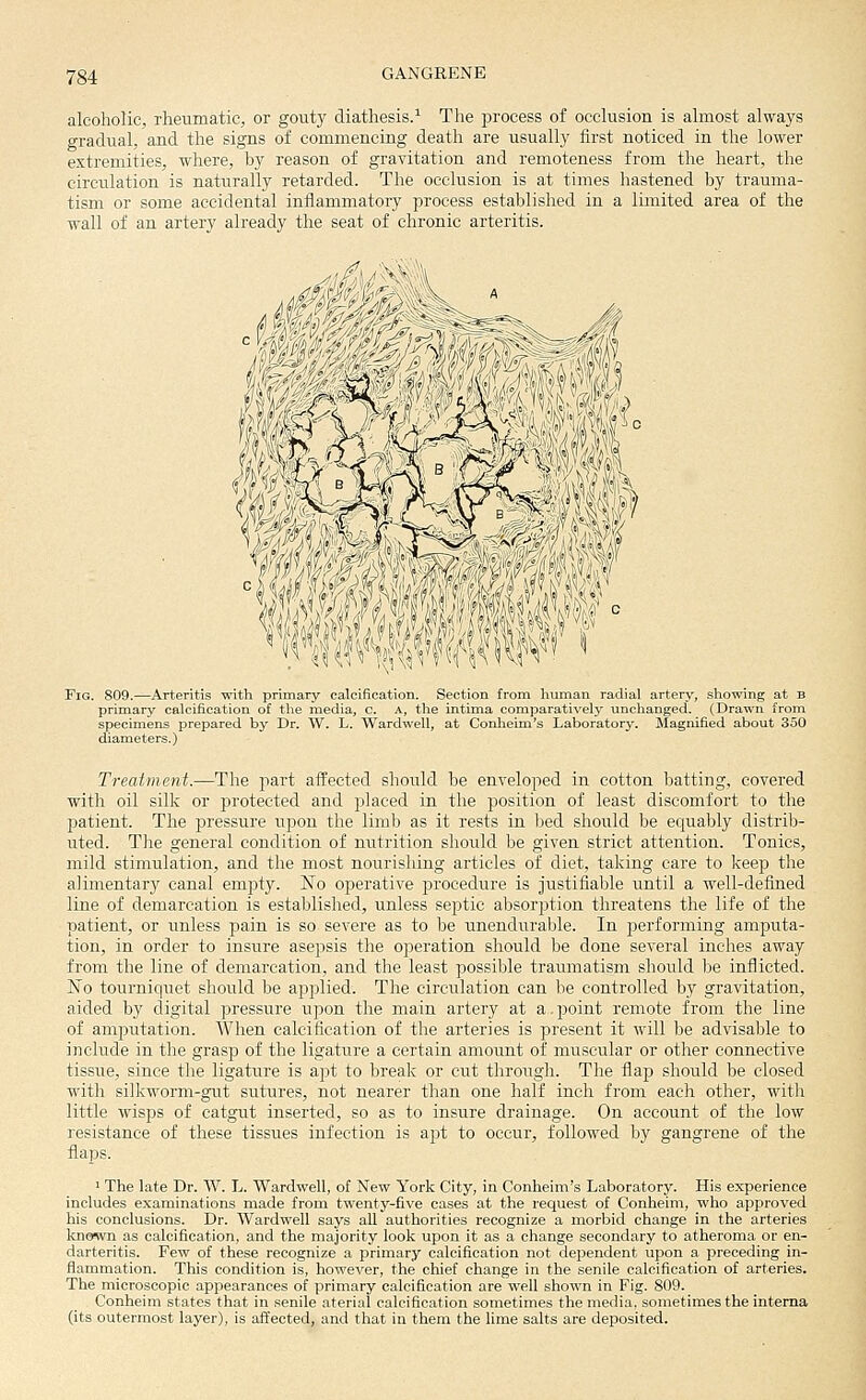 alcoholic, rheumatic, or gouty diathesis.^ The process of occlusion is almost always gradual, and the signs of commencing death are usually first noticed in the lower extremities, wliere, by reason of gravitation and remoteness from the heart, the circulation is naturally retarded. The occlusion is at times hastened by trauma- tism or some accidental inflammatory process establislied in a limited area of the wall of an artery already the seat of chronic arteritis. •> Fig. 809.—Arteritis with primary calcification. Section from human radial artery, showing at B primary calcification of the media, c. A, the intima comparatively unchanged. (Drawn from specimens prepared by Dr. W. L. Wardwell, at Conlieim's Laboratory. Magnified about 350 diameters.) Treatment.—The part affected should be enveloped in cotton batting, covered with oil silk or protected and placed in the position of least discomfort to the patient. The pressure upon the limb as it rests in l^ed should be equably distrib- uted. The general condition of nutrition should be given strict attention. Tonics, mild stimulation, and the most nourishing articles of diet, taking care to keep the alimentary canal empty. No operative procedure is justifiable until a well-defined line of demarcation is established, unless septic absorption threatens the life of the patient, or unless pain is so severe as to be unendurable. In j^erforming amputa- tion, in order to insure asepsis the operation should be done several inches away from the line of demarcation, and the least possible traumatism should 1'je inflicted. JSTo tourniquet should be applied. The circulation can be controlled by gravitation, aided by digital pressure upon the main artery at a, 2)oint remote from the line of amiDutation. When calcification of the arteries is present it will be advisable to include in the grasp of the ligature a certain amount of muscular or other connective tissue, since the ligature is apt to break or cut through. The flap should be closed with silkworm-gut sutures, not nearer than one half inch from each other, with little wisps of catgut inserted, so as to insure drainage. On account of the low resistance of these tissues infection is apt to occur, followed by gangrene of the flaps. 1 The late Dr. W. L. Wardwell, of New York City, in Conlieim's Laboratory. His experience includes examinations made from twenty-five cases at the request of Conheim, who approved his conclusions. Dr. Wardwell says all authorities recognize a morbid change in the arteries known as calcification, and the majority look upon it as a change secondary to atheroma or en- darteritis. Few of these recognize a primary calcification not dependent upon a preceding in- flammation. This condition is, however, the chief change in the senile calcification of arteries. The microscopic appearances of primary calcification are well shown in Fig. 809. Conheim states that in senile aterial calcification sometimes the media, sometimes the interna (its outermost layer), is affected, and that in them the lime salts are deposited.