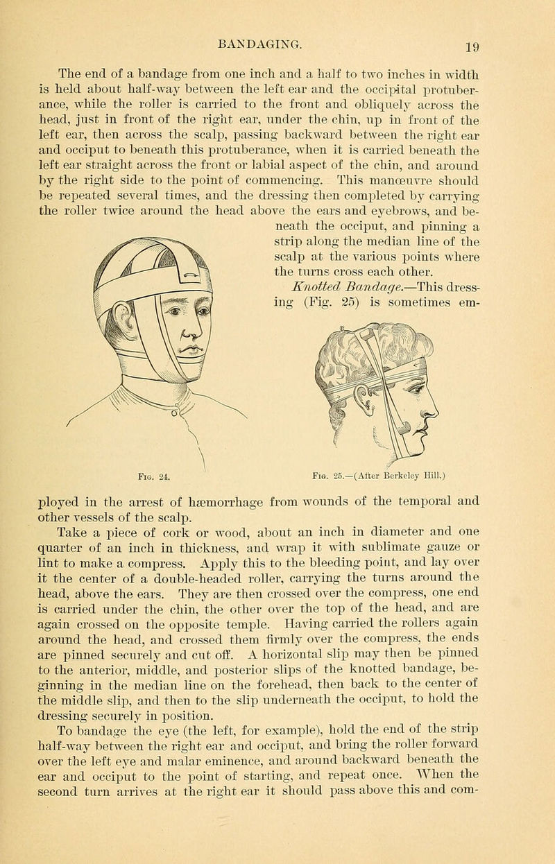 The end of a bandage from one inch and a half to two inches in width is held about half-way between the left ear and the occipital protuber- ance, while the roller is carried to the front and obliquely across the head, just in front of the right ear, under the chin, up in front of the left ear, then across the scalp, passing backward between the right ear and occiput to beneath this protuberance, when it is carried beneath the left ear straight across the front or labial aspect of the chin, and around by the right side to the point of commencing. This manoeuvre should be repeated several times, and the dressing then completed by carrying the roller twice around the head above the ears and eyebrows, and be- neath the occiput, and pinniag a strip along the median line of the scalp at the various points where the turns ci-oss each other. Knotted Bandage.—This dress- ing (Fig. 25) is sometimes em- FiG 25 —(Alter Berkeley Hill.) ployed in the arrest of heemorrhage from wounds of the temporal and other vessels of the scalp. Take a piece of cork or wood, about an inch in diameter and one quarter of an inch in thickness, and wrap it with sublimate gauze or lint to make a compress. Apply this to the bleeding point, and lay over it the center of a double-headed roller, carrying the turns around the head, above the ears. They are then crossed over the compress, one end is carried under the chin, the other over the top of the head, and are again crossed on the opposite temple. Having carried the rollers again around the head, and crossed them firmly over the compress, the ends are pinned securely and cut off. A horizontal slip may then be pinned to the anterior, middle, and posterior slips of the knotted bandage, be- ginning in the median line on the forehead, then back to the center of the middle slip, and then to the slip underneath the occiput, to hold the dressing securely in position. To bandage the eye (the left, for example), hold the end of the strip half-way between the right ear and occiput, and bring the roller forward over the left eye and malar eminence, and around backward beneath the ear and occiput to the point of starting, and repeat once. When the second turn arrives at the right ear it should pass above this and com-