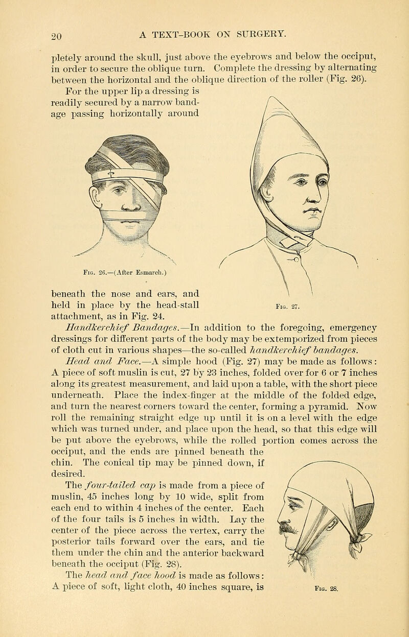 pletely around the skull, just above the eyebrows and below the occiput, in order to secure the oblique turn. Complete the dressing by alternating between the horizontal and the oblique direction of the roller (Fig. 26). For the upper lip a dressing is readily secured by a narrow band- age passing horizontally around Fig. 26.—(After Esmarch.) beneath the nose and ears, and held in place by the head-stall fig. 27. attachment, as in Fig. 24. Handkerchief Bandages.—In addition to the foregoing, emergency dressings for different parts of the body may be extemporized from pieces of cloth cut in various shajjes—the so-called handkerchief bandages. Head and Face.—A simple hood (Fig. 27) may be made as follows: A piece of soft muslin is cut, 27 by 23 inches, folded over for 6 or 7 inches along its greatest measurement, and laid upon a table, with the short piece underneath. Place the index-finger at the middle of the folded edge, and turn the nearest corners toward the center, forming a pyramid. Now roll the remaining straight edge np until it is on a level with the edge which was turned under, and place upon the head, so that this edge will be put above the eyebrows, while the rolled portion comes across the occiput, and the ends are jjinned beneath the chin. The conical tip may be pinned down, if desired. The four-tailed cap is made from a piece of muslin, 45 inches long by 10 wide, split from each end to within 4 inches of the center. Each of the four tails is 5 inches in width. Lay the center of the piece across the vertex, carry the posterior tails forward over the ears, and tie them under the chin and the anterior backward beneath the occiput (Fig. 28). The head and face hood is made as follows: A piece of soft, light cloth, 40 inches square, is