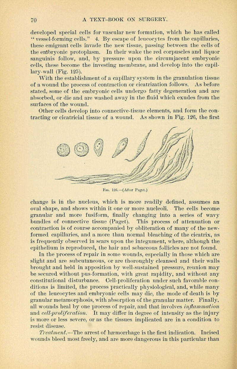 developed special cells for vascular new formation, wMch lie has called vessel-forming cells. 4. By escape of leucocytes from the capillaries, these emigrant cells invade the new tissue, passing between the cells of the enlbryonic protoplasm. In their wake the red corjjuscles and liquor sanguinis follow, and, by pressure upon the circumjacent embryonic cells, these become the investing membrane, and develop into the capil- lary-wall (Fig. 125). With the establishment of a capUlary system in the granulation tissue of a wound the process of contraction or cicatiization follows. As before stated, some of the embryonic cells undergo fatty degeneration and are absorbed, or die and are washed away in the fluid which exudes from the surfaces of the wound. Other cells develop into connective-tissue elements, and form the con- tractins; or cicatricial tissue of a wound. As shown in Fig. 126, the first I'iG. 126.—(After Paget.) change is in the nucleus, which is more readily defined, assumes an oval shape, and shows within it one or more nucleoli. The cells become granular and more fusiform, finally changing into a series of wavy bundles of connective tissue (Paget). This process of attenuation or contraction is of course accompanied by obliteration of many of the new- formed capillaries, and a more than normal bleaching of the cicatrix, as is frequently observed in scars upon the integument, where, although the epithelium is reproduced, the hair and sebaceous fuUicles are not found. In the process of repair in some wounds, especially in those which are slight and are subcutaneous, or are thoroughly cleansed and their walls brought and held in apposition by well-sustained pressure, reunion may be secured without pus-formation, with great rapidity, and without any constitutional disturbance. Cell-proliferation under such favorable con- ditions is limited, the process practically physiological, and, while many of the leucocytes and embryonic cells may die, the mode of death is by granular metamorphosis, with absorption of the granular matter. Finally, all wounds heal by one process of repair, and that involves iriflammaUon and cell-proliferation. It may differ in degiee of intensity as the injury is more or less severe, or as the tissues implicated are in a condition to resist disease. Treatment.—The arrest of haemorrhage is the first indication. Incised wounds bleed most freely, and are more dangerous in this particular than i
