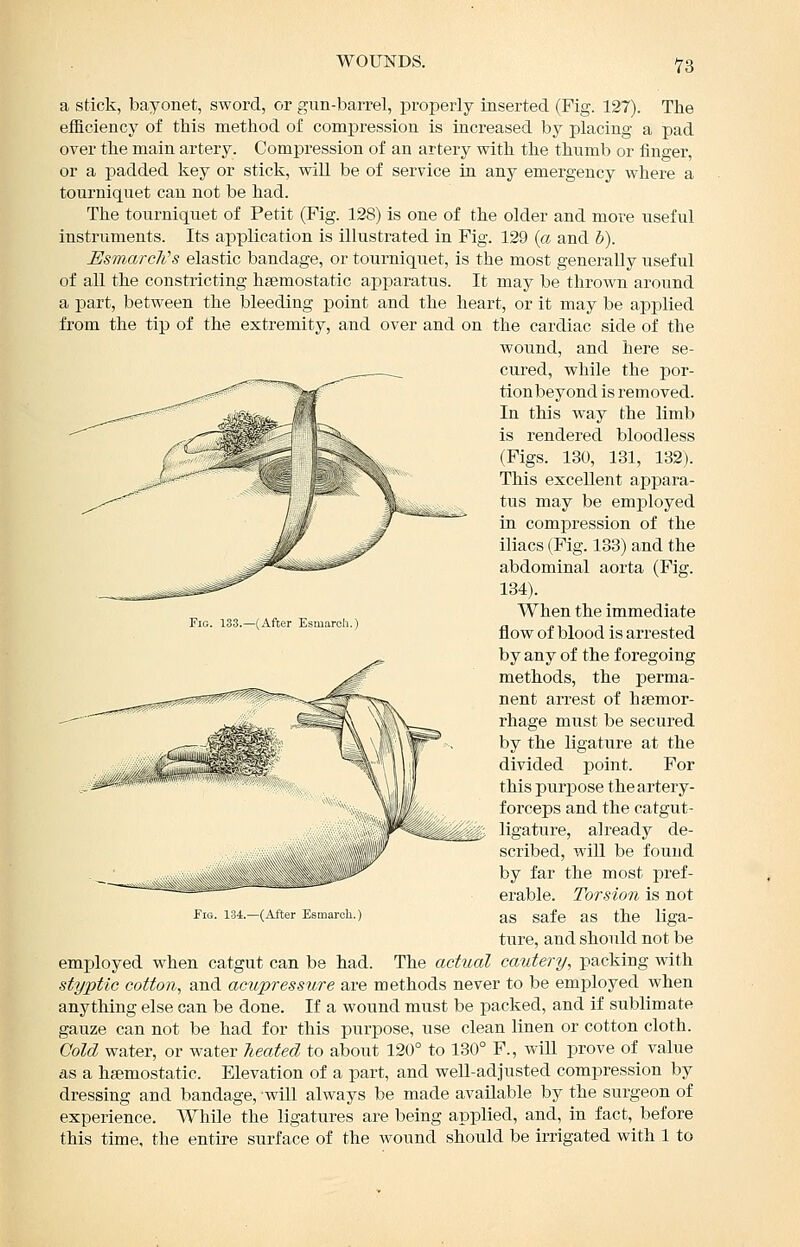 a stick, bayonet, sword, or gun-barrel, properly inserted (Fig. 127). The efficiency of this method of compression is increased by placing a pad over the main artery. Compression of an artery with the thumb or finger, or a padded key or stick, will be of service in any emergency where a tourniquet can not be had. The tourniquet of Petit (Fig. 128) is one of the older and move useful instruments. Its application is illustrated in Fig. 129 {a and h). EsmarcKs elastic bandage, or tourniquet, is the most generally useful of all the constricting haemostatic apparatus. It may be thrown around a part, between the bleeding point and the heart, or it may be applied from the tip of the extremity, and over and on the cardiac side of the wound, and here se- cured, while the por- tion beyond is removed. In this way the limb is rendered bloodless (Figs. 130, 131, 132). This excellent appara- tus may be employed in compression of the iliacs (Fig. 133) and the abdominal aorta (Fig. 134). When the immediate flow of blood is arrested by any of the foregoing methods, the perma- nent arrest of hsemor- rhage must be secured by the ligature at the divided point. For this purpose the artery- forceps and the catgut- ligature, ali-eady de- scribed, will be found by far the most pref- erable. Torsion is not Fia. 134.—(After Esmaroh.) as Safe as the liga- ture, and should not be employed when catgut can be had. The actual cautery, packing with styptic cotton., and acupressure are methods never to be employed when anything else can be done. If a wound must be packed, and if sublimate gauze can not be had for this purpose, use clean linen or cotton cloth. Gold water, or water Tieated to about 120° to 130° F., will prove of value as a haemostatic. Elevation of a part, and well-adjusted compression by dressing and bandage, will always be made available by the surgeon of experience. AVhile the ligatures are being applied, and, in fact, before this time, the entire surface of the wound should be irrigated with 1 to Fig. 133.—(After Esmareh.)