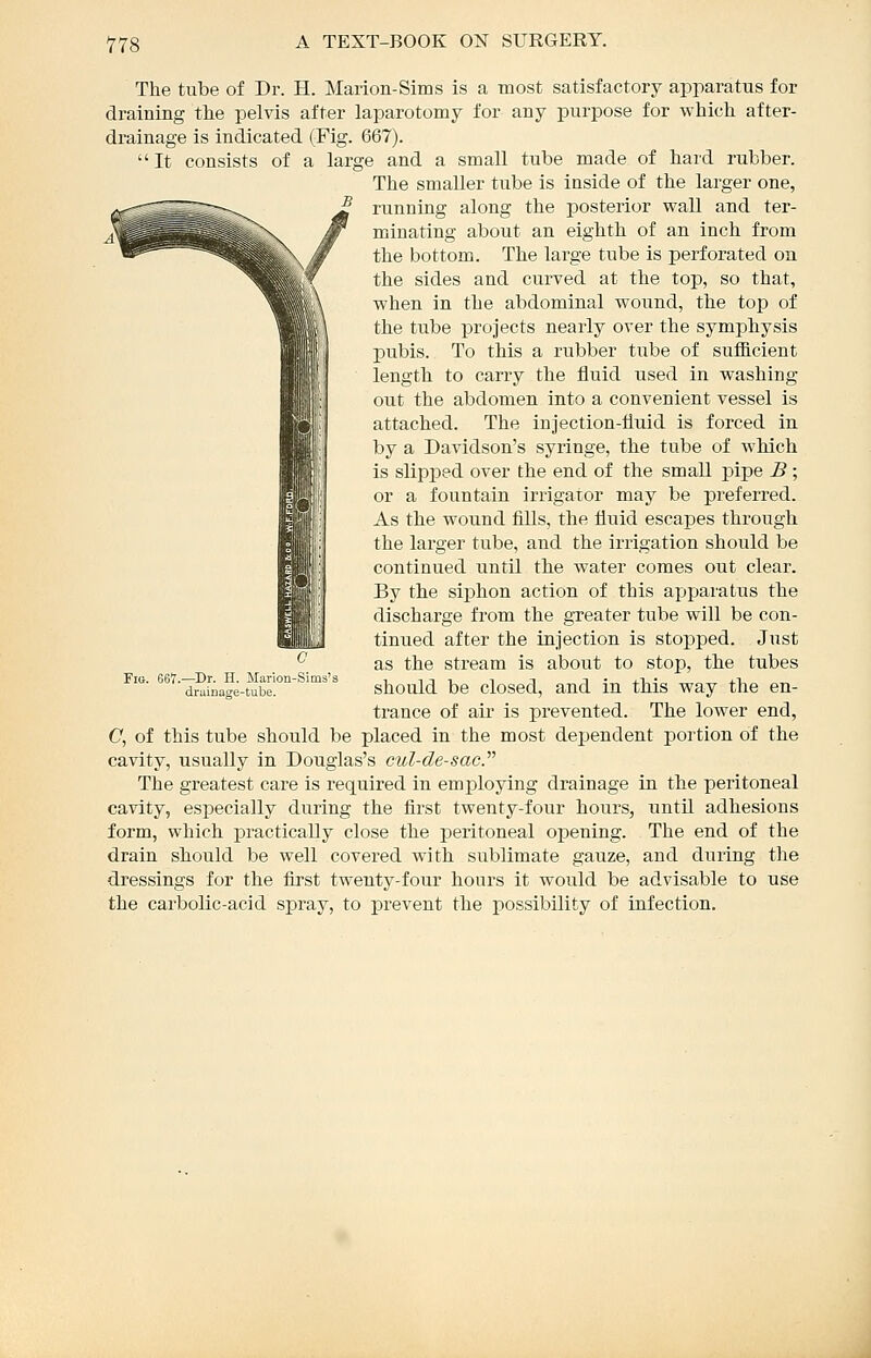 The tube of Dr. H. Marion-Sims is a most satisfactory apparatus for draining the pelvis after laparotomy for any purpose for which after- drainage is indicated (Fig. 667). It consists of a large and a small tube made of hard rubber. The smaller tube is inside of the larger one, running along the posterior wall and ter- minating about an eighth of an inch from the bottom. The large tube is perforated on the sides and curved at the top, so that, when in the abdominal woiind, the top of the tube projects nearly over the symphysis pubis. To this a rubber tube of sufficient length to carry the fluid used in washing- out the abdomen into a convenient vessel is attached. The injection-fluid is forced in by a Davidson's syringe, the tube of which is slipped over the end of the small pipe B ; or a fountain irrigator may be preferred. As the wound fills, the fluid escapes through the larger tube, and the irrigation should be continued until the water comes out clear. By the siphon action of this apparatus the discharge from the greater tube will be con- tinued after the injection is stopped. Just as the stream is about to stop, the tubes should be closed, and in this way the en- ti'ance of air is prevented. The lower end, C, of this tube should be placed in the most dependent portion of the cavity, usually in Douglas's cul-de-sac.'''' The greatest care is required in employing drainage in the peritoneal cavity, especially during the first twenty-four hours, until adhesions form, which practically close the jDeritoneal opening. The end of the drain should be well covered with sublimate gauze, and during the dressings for the first twenty-four hours it would be advisable to use the carbolic-acid spray, to prevent the possibility of infection. Fio. 667.—Dr. H. Marion-Sims'i drainage-tube.