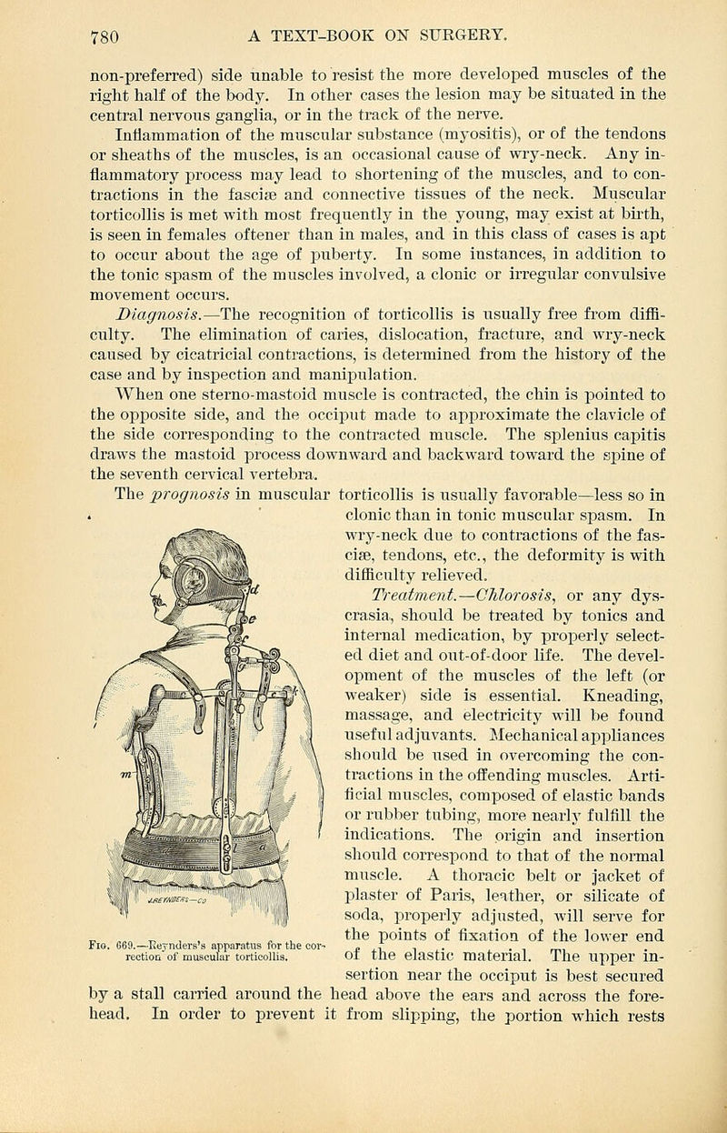 non-preferred) side unable to resist the more developed muscles of the right half of the body. In other cases the lesion may be situated in the central nervoiis ganglia, or in the track of the nerve. Inhammation of the muscular substance (myositis), or of the tendons or sheaths of the muscles, is an occasional cause of wry-neck. Any in- flammatory process may lead to shortening of the muscles, and to con- tractions in the fasciee and connective tissues of the neck. Muscular torticollis is met with most frequently in the young, may exist at birth, is seen in females oftener than in males, and in this class of cases is apt to occur about the age of ptiberty. In some instances, in addition to the tonic spasm of the muscles involved, a clonic or irregular convulsive movement occurs. Diagnosis.—The recognition of torticollis is usually free from difB- culty. The elimination of caries, dislocation, fracture, and wry-neck caused by cicatricial contractions, is determined from the history of the case and by inspection and manipulation. When one sterno-mastoid muscle is contracted, the chin is pointed to the opposite side, and the occiput made to approximate the clavicle of the side corresponding to the contracted muscle. The splenius capitis draws the mastoid process downward and backward toward the spine of the seventh cervical vertebra. The prognosis in muscular torticollis is usually favorable—less so in . ' clonic than in tonic muscular spasm. In wry-neck due to contractions of the fas- ciae, tendons, etc., the deformity is with difiicnlty relieved. Treatment.—Chlorosis., or any dys- crasia, should be treated by tonics and internal medication, by properly select- ed diet and out-of-door life. The devel- opment of the muscles of the left (or weaker) side is essential. Kneading, massage, and electricity will be found useful adjuvants. Mechanical appliances should be used in overcoming the con- tractions in the offending muscles. Arti- ficial muscles, composed of elastic bands or rubber tubing, more nearh' fulfill the indications. The origin and insertion should correspond to that of the normal muscle. A thoracic belt or jacket of plaster of Paris, leather, or silicate of soda, properly adjusted, will serve for the points of fixation of the lower end of the elastic material. The upper in- sertion near the occiput is best secured by a stall carried around the head above the ears and across the fore- head. In order to prevent it from slipping, the portion which rests Fio, 669.—Eeynders's apparatus for the cor reotion of muscular torticollis.