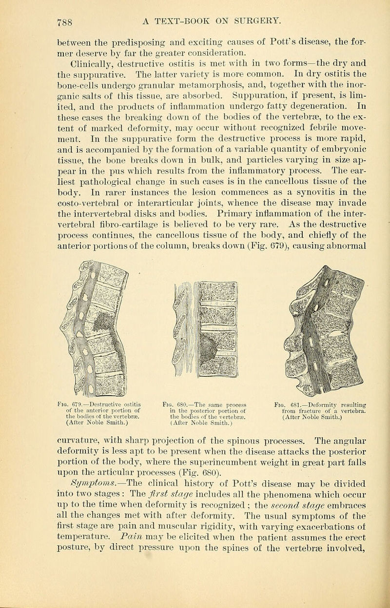 between the predisposing and exciting causes of Pott's disease, the for- mer deserve by far the greater consideration. Clinically, destructive ostitis is met with in two forms—the dry and the suppurative. The latter variety is more common. In dry ostitis the bone-cells imdergo granular metamorphosis, and, together with the inor- ganic salts of this tissue, are absorbed. Suppuration, if present, is lim- ited, and the products of inflammation undergo fatty degeneration. In these cases the breaking down of the bodies of the vertebrae, to the ex- tent of marked deformity, may occur without recognized febrile move- ment. In the supiDurative form the destructive process is more rapid, and is accompanied by the formation of a variable quantity of embryonic tissue, the bone breaks down in bulk, and particles varying in size ap- pear in the pus which results from the inflammatory process. The ear- liest pathological change in such cases is in the cancellous tissue of the body. In rarer instances the lesion commences as a synovitis in the costo-vertebral or interarticular joints, whence the disease may invade the intervertebral disks and bodies. Primary inflammation of the inter- vertebral fibro-cartilage is believed to be very rare. As the destructive process continnes, the cancellous tissue of the body, and chiefly of the anterior portions of the column, breaks down (Fig. 679), causing abnormal Fio. 679.—Destructive ostitis of tlie anterior portion of the bodies of ttie vertebra. (After Noble Smith.) Fig. 680.—The same process in the posterior portion of the bodies of the vertebrie. (After Noble Smith.) Fig. 681.—Deformity resulting from fracture of a vertebra. (Alter Noble Smith.) curvature, with sharp projection of the spinous processes. The angular deformity is less apt to be present when the disease attacks the posterior portion of the body, where the superincumbent weight in great part falls upon the articular processes (Fig. 680). Si/jnptoms.—The clinical history of Pott's disease may be divided into two stages : The first stage includes all the phenomena which occur up to the time when deformity is recognized ; the second stage embraces all the changes met with after deformity. The usual symptoms of the first stage are pain and muscular rigidity, with varying exacerbations of temperature. Pain may be elicited when the patient assumes the erect posture, by direct pressure upon the spines of the vertebrae involved,