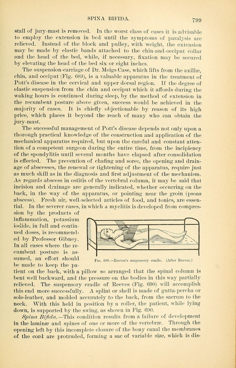 SPINA BIFIDA. stall of jury-mast is removed. In the worst class of cases it is advisable to employ the extension in bed until the symptoms of paralysis are relieved. Instead of the block and pulley, with weight, the extension may be made by elastic bands attached to the chin-and-occiput collar a,nd the head of the bed, while, if necessary, fixation may be secured by elevating the head of the bed six or eight inches. The suspension-carriage of Dr. Meigs Case, which lifts from the axillee, chin, and occiput (Fig. 689), is a valuable apparatus in the treatment of Pott's disease in the cervical and upper dorsal region. If the degree of elastic suspension from the chin and occiput which it affords during the waking hours is continued during sleep, by the method of extension in the recumbent posture above given, success would be achieved in the majority of cases. It is chiefly objectionable by reason of its high price, which places it beyond the reach of many who can obtain the jury-mast. The successful management of Pott's disease depends not only upon a thorough practical knowledge of the construction and application of the mechanical apparatus required, but upon the careful and constant atten- tion of a competent surgeon during the entire time, from the incij^iency of the spondylitis until several months have elapsed after consolidation is effected. The prevention of chafing and sores, the opening and drain- age of abscesses, the renewal or tightening of the apparatus, require just as much skill as in the diagnosis and first adjustment of the mechanism. As regards abscess in ostitis of the vertebral cohimn, it may be said that incision and drainage are generally indicated, whether occurring on the back, in the way of the apparatus, or pointing near the groin (psoas abscess). Fresh air, well-selected articles of food, and tonics, are essen- tial. In the severer cases, in which a myelitis is developed from compres- sion by the products of inflammation, potassium rfipv^ ~™^ = —— —f ^ iodide, in full and contin-  ^ ■--■^-^ ■ ~  * ued doses, is recommend- ed by Professor Gibney. In all cases where the re- cumbent posture is as- sumed, an effort should be made to keep the pa- tient on the back, with a pillow so arranged that the spinal column is bent well backward, and the pressure on the bodies in this way partially relieved. The suspensory cradle of Reeves (Fig. 690) will accomplish this end more successfully. A splint or shell is made of gutta-percha or sole-leather, and molded accurately to the back, from the sacrum to the neck. With this held in position by a roller, the patient, while lying down, is supported by the swing, as shown in Fig. 690. Spina Bifida.—This condition results from a failure of development in the laminae and spines of one or more of the vertebrae. Through the opening left by this incomplete closure of the bony canal the membranes of the cord are protruded, forming a sac of variable size, which is dis- FiG. 690.—Eeeves's suspensory cradle. (After Eeeves.)