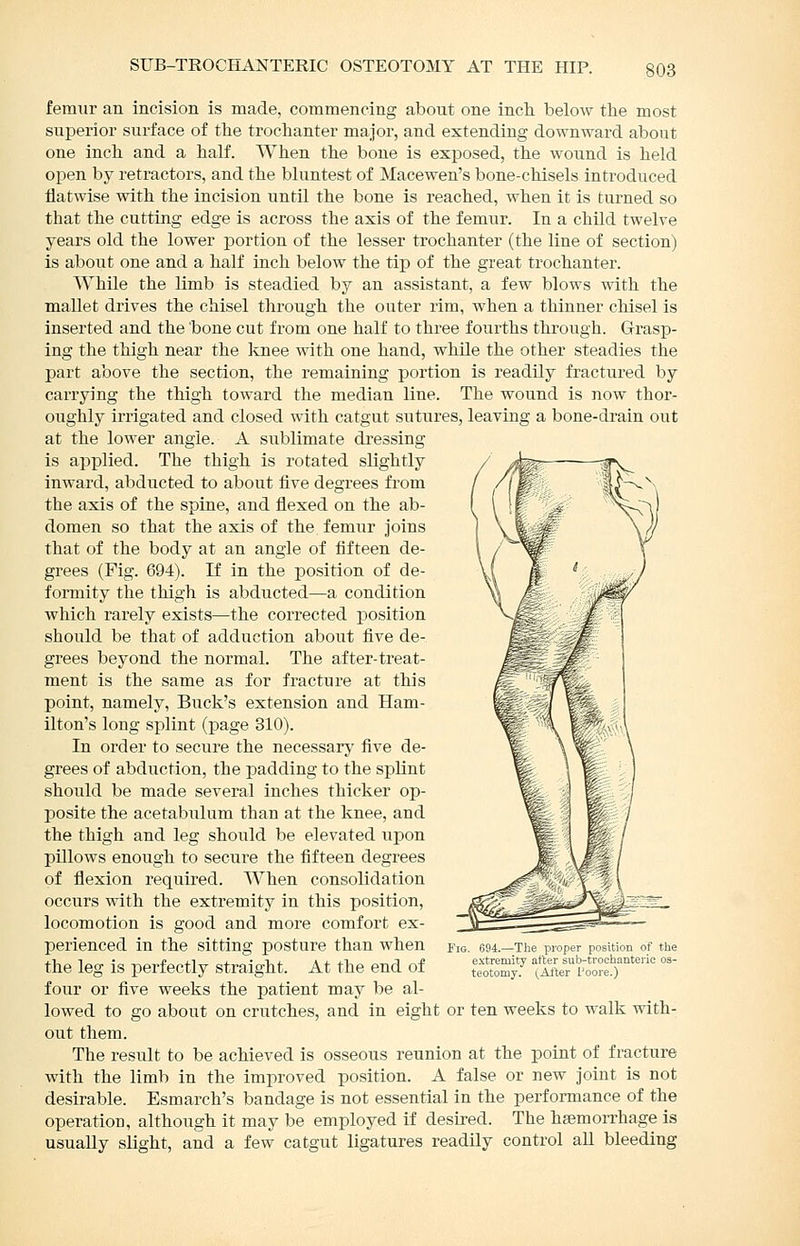 SUB-TROCHANTERIC OSTEOTOMY AT THE HIP. femur an incision is made, commencing about one inch, below tlie most superior surface of tbe trochanter major, and extending downward about one inch and a half. When the bone is exposed, the wound is held open by retractors, and the bluntest of Macewen's bone-chisels introduced flatwise with the incision until the bone is reached, when it is turned so that the cutting edge is across the axis of the femur. In a child twelve years old the lower portion of the lesser trochanter (the line of section) is about one and a half inch below the tip of the great trochanter. While the limb is steadied by an assistant, a few blows with the mallet drives the chisel through the outer rim, when a thinner chisel is inserted and the bone cut from one half to three fourths through. Grasp- ing the thigh near the knee with one hand, while the other steadies the part above the section, the remaining portion is readily fractured by carrying the thigh toward the median line. The wound is now thor- oughly irrigated and closed with catgut sutures, leaving a bone-drain out at the lower angle. A sublimate dressing is applied. The thigh is rotated slightly inward, abducted to about five degrees fi-om the axis of the spine, and flexed on the ab- domen so that the axis of the femur joins that of the body at an angle of fifteen de- grees (Fig. 694). If in the position of de- formity the thigh is abducted—a condition which rarely exists—the corrected position should be that of adduction about five de- grees beyond the normal. The after-treat- ment is the same as for fracture at this point, namely, Buck's extension and Ham- ilton's long splint (page 310). In order to secure the necessarj' five de- grees of abduction, the padding to the splint should be made several inches thicker op- posite the acetabulum than at the knee, and the thigh and leg should be elevated upon pillows enough to secure the fifteen degrees of flexion required. When consolidation occurs with the extremity in this position, locomotion is good and more comfort ex- perienced in the sitting posture than when the leg is perfectly straight. At the end of four or five weeks the patient may be al- lowed to go about on crutches, and in eight or ten weeks to walk with- out them. The result to be achieved is osseous reunion at the point of fracture with the limb in the improved position. A false or new joint is not desirable. Esmarch's bandage is not essential in the performance of the operation, although it may be employed if desired. The haemorrhage is usually slight, and a few catgut ligatures readily control all bleeding 694.—The proper position of the extremity after sub-trochanteric os- teotonry. (After I'oore.)