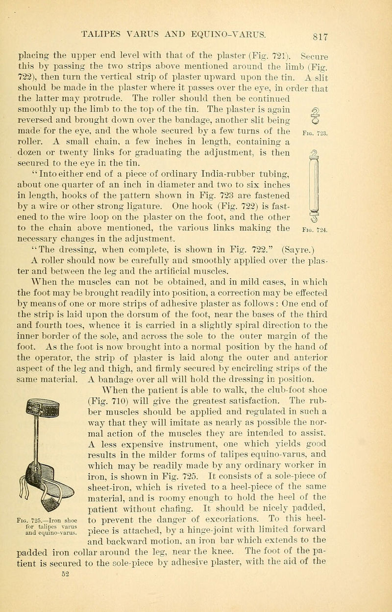 placing tlie upper end level with that of the plaster (Pig. 721). Secure this by passing the two strips above mentioned around the limb (Fig. 722), then turn the vertical strijD of plaster upward upon the tin. A slit should be made in the plaster where it passes over the eye, in order that the latter may protrude. The roller should then be continued smoothly up the limb to the top of the tin. The plaster is again S) reversed and brought down over the bandage, another slit being q made for the eye, and the whole secured by a few turns of the fig. 723. roller. A small chain, a few inches in length, containing a dozen or twenty links for graduating the adjustment, is then Q^ secured to the eye in the tin. Intoeither end of a piece of ordinary India-rubber tubing, about one quarter of an inch in diameter and two to six inches in length, hooks of the pattern shown in Fig. 723 are fastened by a wire oj- other strong ligature. One hook (Fig. 722) is fast- ened to the wire loop on the plaster on the foot, and the other ^ to the chain above mentioned, the various links making the fig. 724. necessary changes in the adjustment. ''The dressing, when complete, is shown in Fig. 722. (Sayre.) A roller should now be carefully and smoothly applied over the plas- ter and between the leg and the artificial muscles. When the muscles can not be obtained, and in mild cases, in which the foot may be brought readily into position, a correction may be effected by means of one or more strips of adhesive plaster as follows : One end of the strip is laid upon the dorsum of the foot, near the bases of the third and fourth toes, whence it is carried in a slightly sjMral direction to the inner border of the sole, and across the sole to the outer margin of the foot. As the foot is now brought into a normal position by the hand of the operator, the strip of plaster is laid along the outer and anterior aspect of the leg and thigh, and firmly secured by encircling strips of the same material. A bandage over all will hold the dressing in position. When the patient is able to walk, the club-foot shoe (Fig. 710) will give the greatest satisfaction. The rub- ber muscles shoiild be ajDplied and regulated in such a way that they will imitate as nearly as possible the nor- mal action of the muscles they are intended to assist. A less expensive instrument, one which yields good residts in the milder forms of talipes equino-varus, and which may be readily made by any ordinary worker in iron, is shown in Fig. 725. It consists of a sole-piece of sheet-iron, which is riveted to a heel-piece of the same material, and is roomy enough to hold the heel of the patient without chafing. It should be nicely padded, Fig. r25.-iion shoe to prevent the danger of excoriations. To this heel- ^'d eq^o-^rill! piece is attached, by a hinge-joint with limited forward and backward motion, an iron bar which extends to the padded iron collar around the leg, near the knee. The foot of the pa- tient is secured to the sole-piece by adhesive plaster, with the aid of the 52