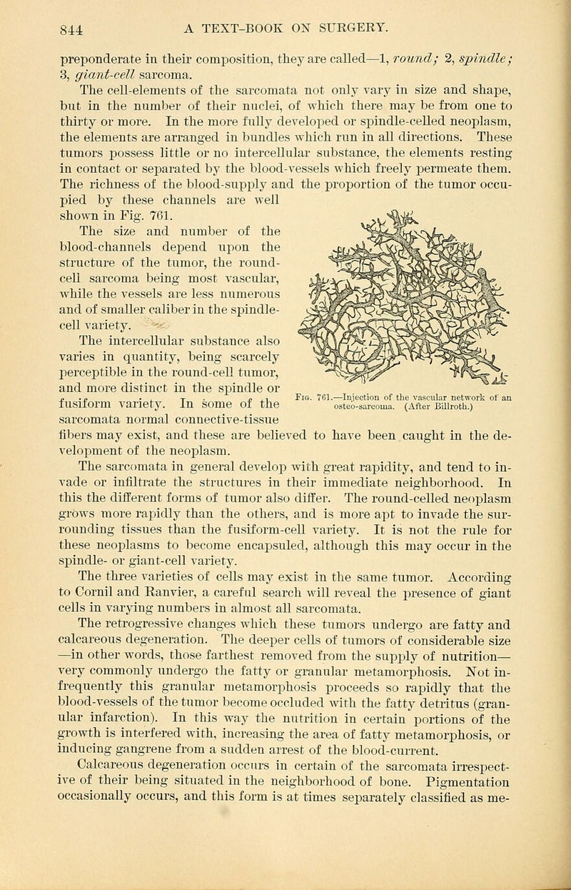 preponderate in their composition, tliey are called—1, round; 2, spindle; 3, giant-cell sarcoma. The cell-elements of the sarcomata not only vary in size and shape, but in the number of their nuclei, of which there may be from one to thirty or more. In the more fully developed or spindle-celled neoplasm, the elements are arranged in bundles which run in all directions. These tumors possess little or no intercellular substance, the elements resting in contact or separated by the blood-vessels which freely permeate them. The richness of the blood-supply and the proportion of the tumor occu- pied by these channels are well shown in Fig. 761. The size and number of the blood-channels depend upon the structure of the tumor, the round- ceU sarcoma being most vascular, while the vessels are less numerous and of smaller caliber in the spindle- cell variety. The intercellular substance also varies in quantity, being scarcely perceptible in the round-cell tumor, and more distinct in the spindle or J. .» . . T • J! J.1 J^io- '61-—Iniection of the vascular network of an fusiform variety. In some of the osteo-sarcoma. (After Billroth.) sarcomata normal connective-tissue fibers may exist, and these are believed to have been caught in the de- velopment of the neoplasm. The sarcomata in general develop with great rapidity, and tend to in- vade or infiltrate the structures in their immediate neighborhood. In this the different forms of tumor also differ. The round-celled neoplasm grows more rapidly than the others, and is more apt to invade the sur- rounding tissues than the fusiform-cell variety. It is not the rule for these neoplasms to become encapsuled, although this may occur in the spindle- or giant-cell variety. The three varieties of cells may exist in the same tumor. According to Cornil and Ranvier, a careful search will reveal the presence of giant cells in varying numbers in almost all sarcomata. The retrogressive changes which these tumors undergo are fatty and calcareous degeneration. The deeper cells of tumors of considerable size —in other words, those farthest removed from the supjjly of nutrition— very commonly undergo the fatty or granular metamorphosis. Not in- frequently this granular metamorphosis proceeds so rapidly that the blood-vessels of the tumor become occluded with the fatty detritus (gran- ular infarction). In this way the nutrition in certain portions of the growth is interfered with, increasing the area of fatty metamorphosis, or inducing gangrene from a sudden arrest of the blood-current. Calcareous degeneration occurs in certain of the sarcomata irrespect- ive of their being situated in the neighborhood of bone. Pigmentation occasionally occurs, and this form is at times separately classified as me-
