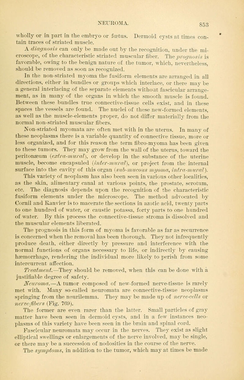 XEmOMA. 833 wholly or in part in the embryo or foetus. Dermoid cysts at times con- tain traces of striated muscle. A diagnosis can only be made out by the recognition, under the mi- croscope, of the characteristic striated muscular fiber. The j)rognosis is favorable, omng to the benign nature of the tumor, which, nevertheless, should be removed as soon as recognized. In the non-striated myoma the fusiform elements are arranged in all directions, either in bundles or groups which interlace, or there may be a general interlacing of the separate elements without fascicular arrange- ment, as in many of the organs in which the smooth muscle is found. Between these bundles true connective-tissue cells exist, and in these spaces the vessels are found. The nuclei of these new-formed elements, as well as the muscle-elements proper, do not differ materially from the normal non-striated muscular fibers. Non-striated myomata are often met with in the uterus. In many of these neoijlasms there is a variable quantity of connective tissue, more or less organized, and for this reason the term fibro-myoma has been given to these tumors. They may grow from the waU of the uterus, toward the peritonaeum {extra-mural), or develop in the substance of the uterine muscle, become encapsuled {inter-mural), or project from the internal surface into the cavity of this organ {sub-mucous myoma, intra-nnrral). This variety of neoplasm has also been seen in various other localities, as the skin, alimentary canal at various points, the prostate, scrotum, etc. The diagnosis depends upon the recognition of the characteristic fusiform elements under the microscope. The method advocated by Comil and Eanvier is to macerate the sections in azotic acid, twenty parts to one hundred of water, or caustic potassa, forty parts to one hundred of water. By this process the connective-tissue stroma is dissolved and the muscular elements liberated. The prognosis in this form of myoma is favorable as far as recurrence is concerned when the removal has been thorough. They not infrequently produce death, either directly by pressure and interference with the normal functions of organs necessary to life, or indirectly by causing hfemorrhage, rendering the individual more likely to perish from some Intercurrent affection. Treatment.—They should be removed, when this can be done with a justifiable degree of safety. Neuroma.—A tumor composed of new-formed nerve-tissue is rarely met with. Many so-called neuromata are connective-tissue neoplasms springing from the neurilemma. They may be made up of nerve-cells or nerve-fibers (Fig. 769). The former are even rarer than the latter. Small particles of gray matter have been seen in dermoid cysts, and in a few instances neo- plasms of this variety have been seen in the brain and spinal cord. Fascicular neuromata may occur in the nerves. They exist as slight elliptical swellings or enlargements of the nei-ve involved, may be single, or there may be a succession of nodosities in the course of the nerve. The symptoms, in addition to the tumor, which may at times be made